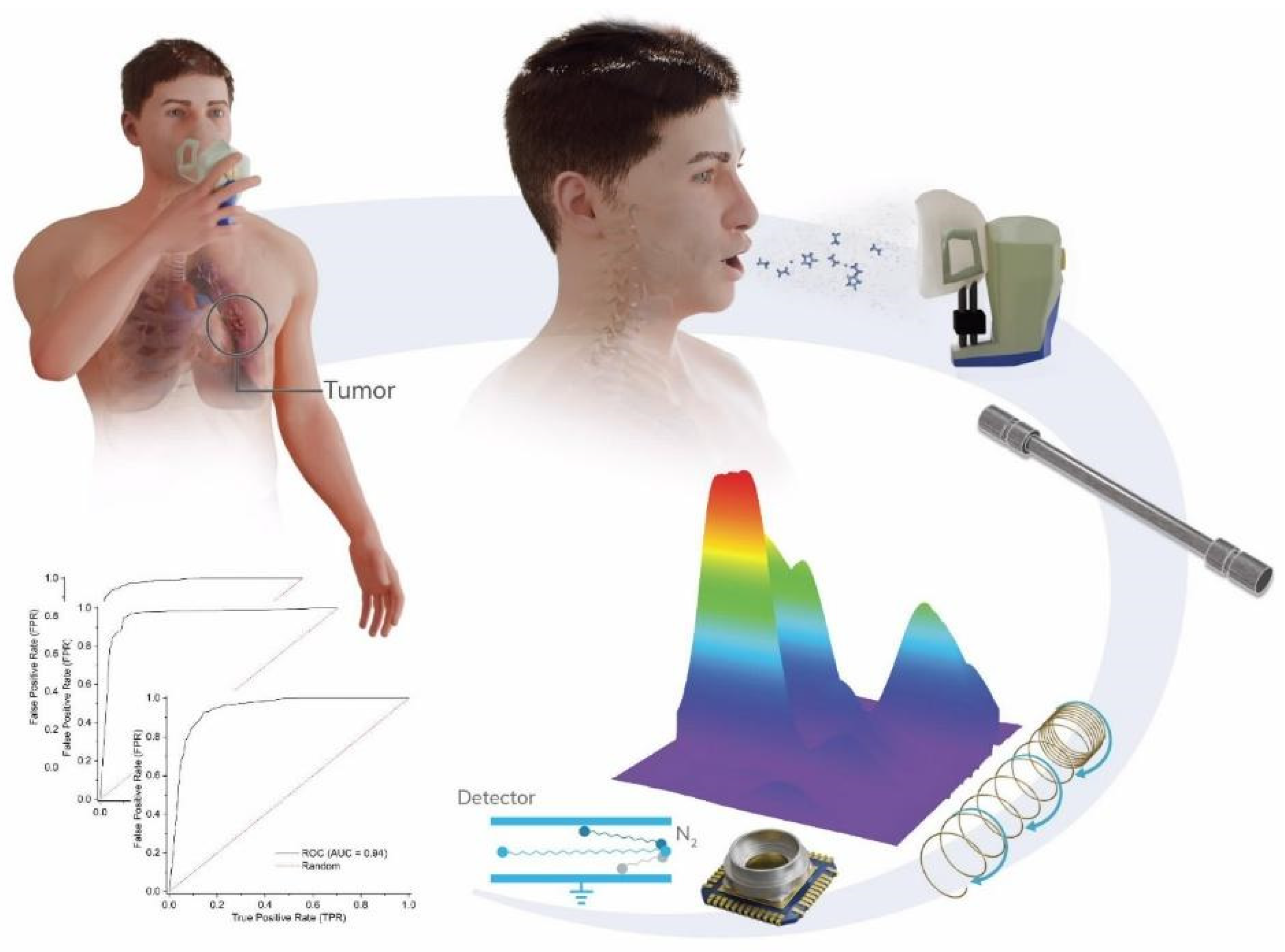 Cancers 17 01685 g001