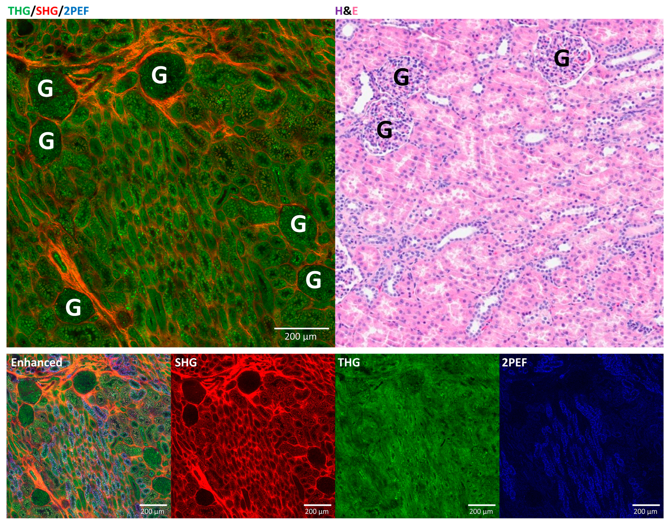 Cancers 17 01693 g002