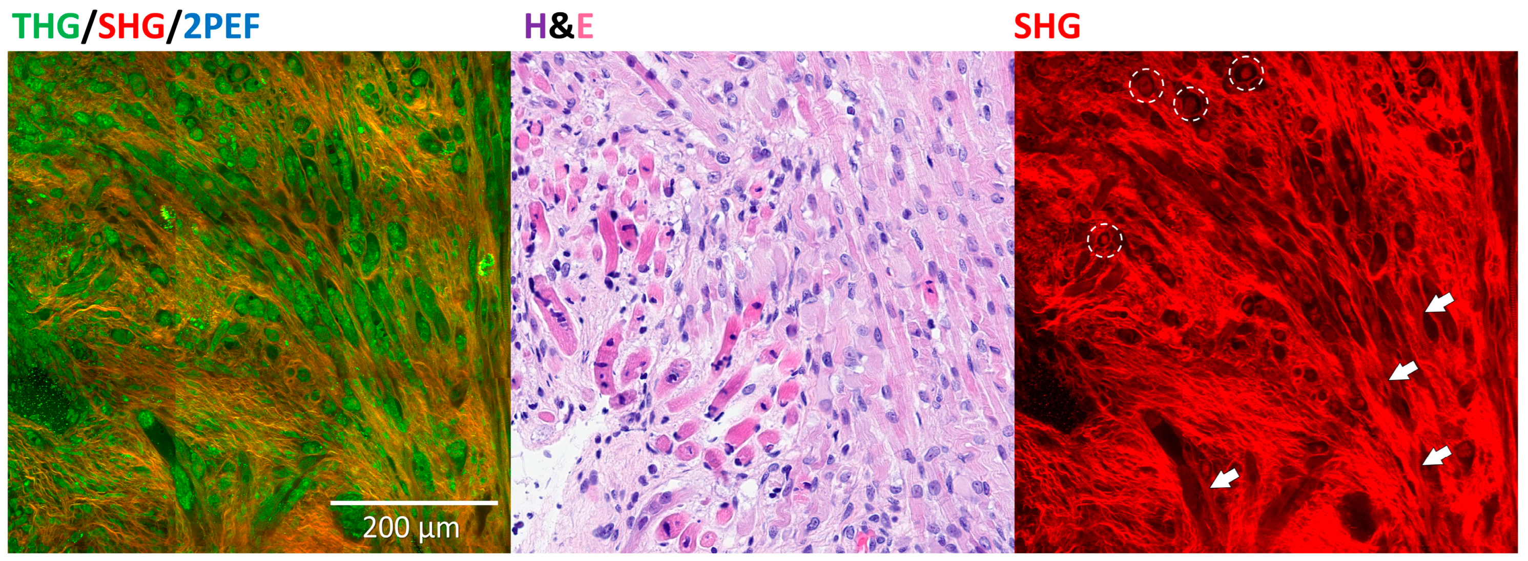 Cancers 17 01693 g004