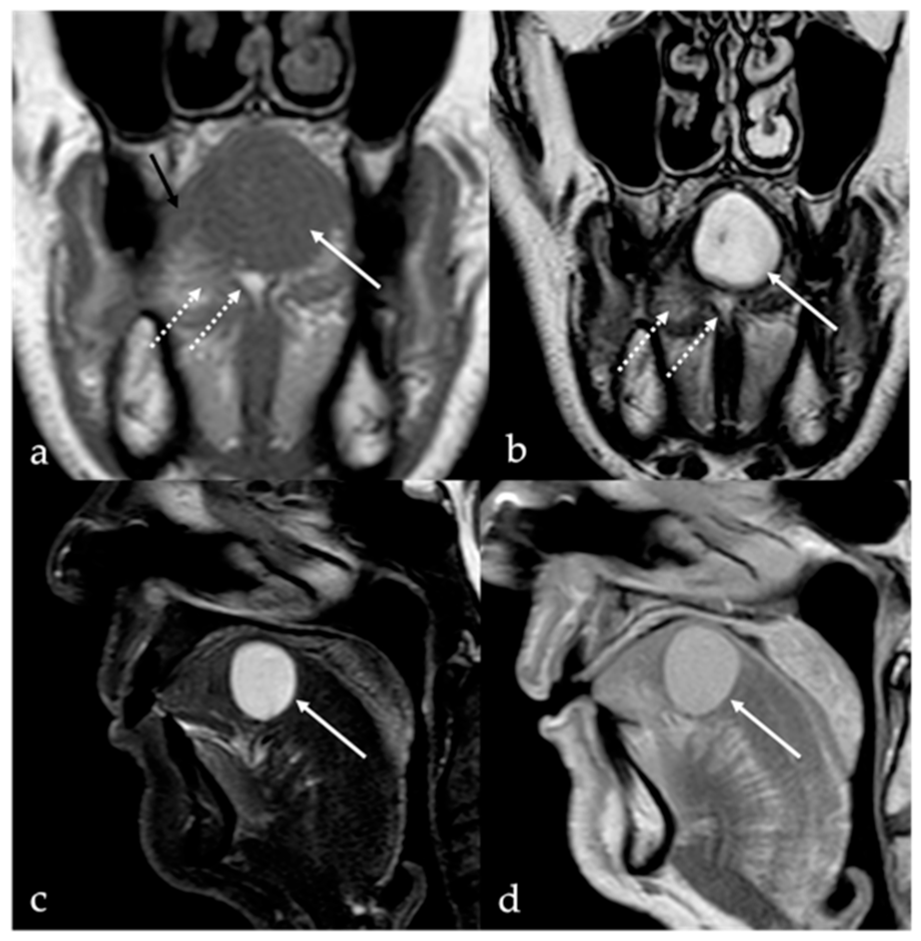 Cancers 17 01695 g001