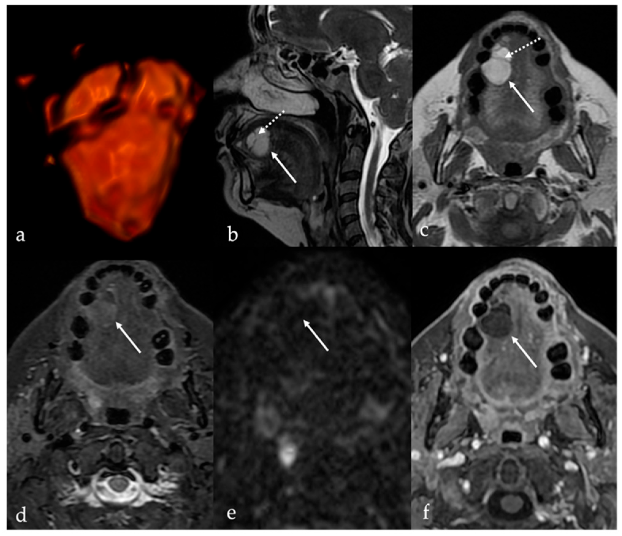 Cancers 17 01695 g002