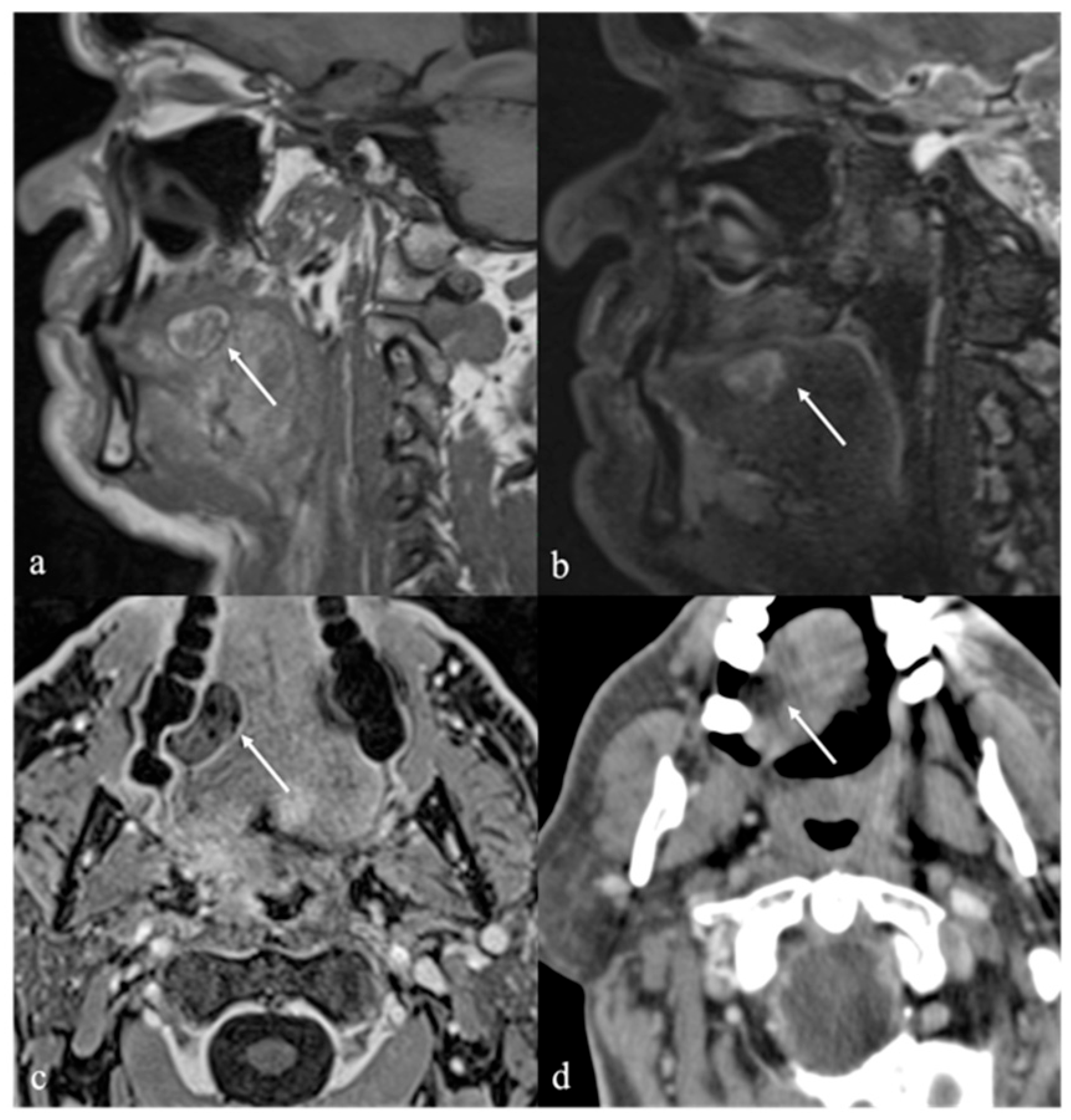 Cancers 17 01695 g003