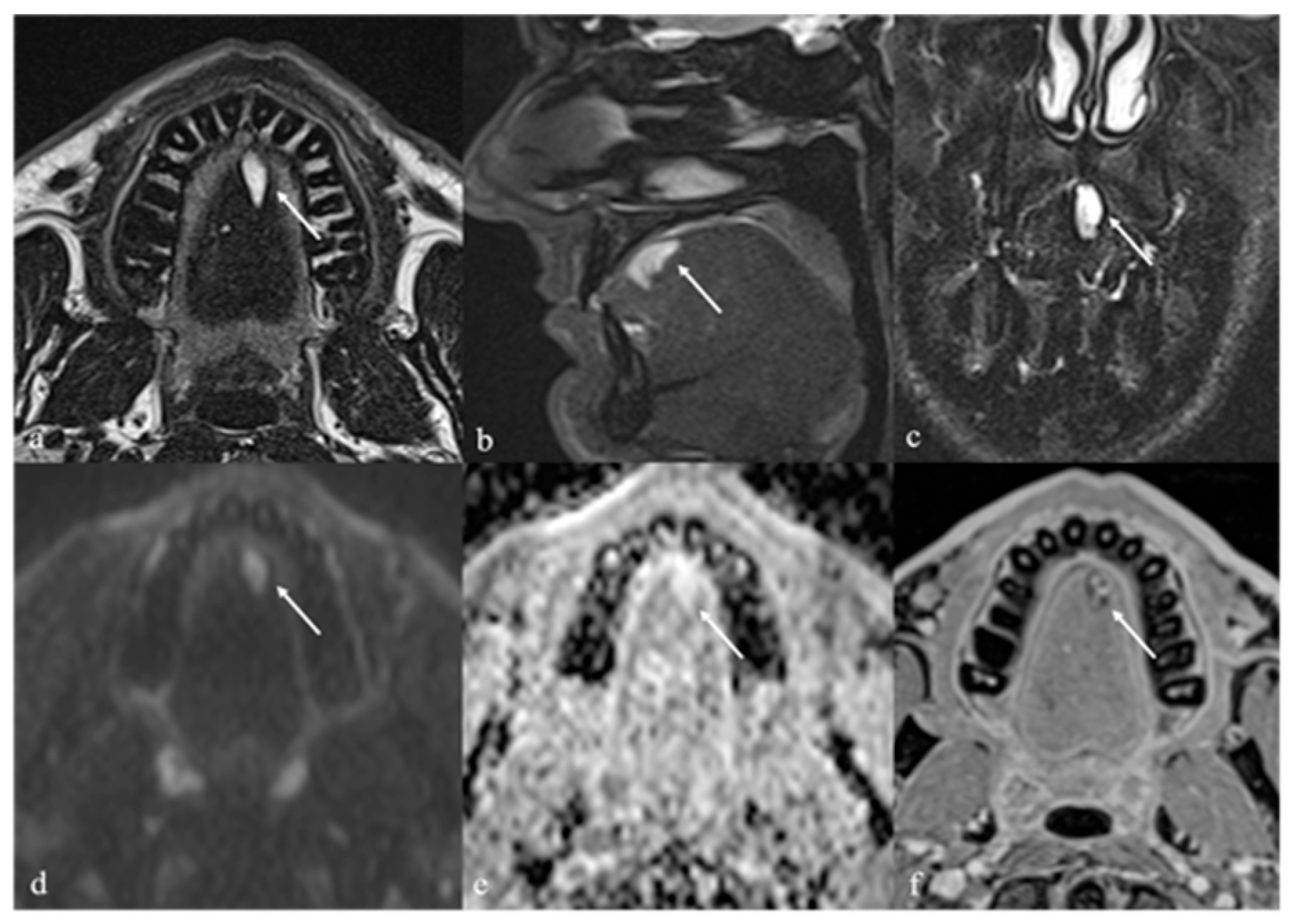 Cancers 17 01695 g004