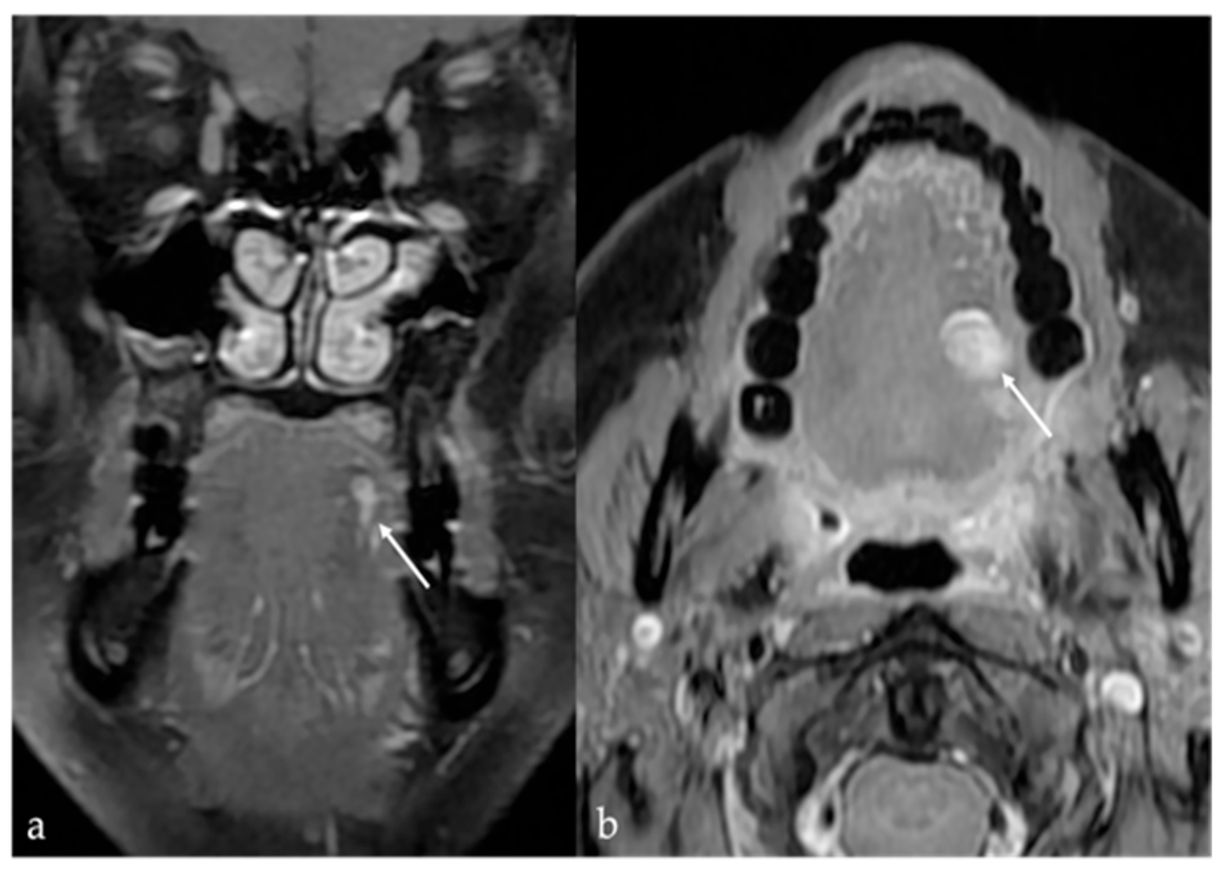 Cancers 17 01695 g005