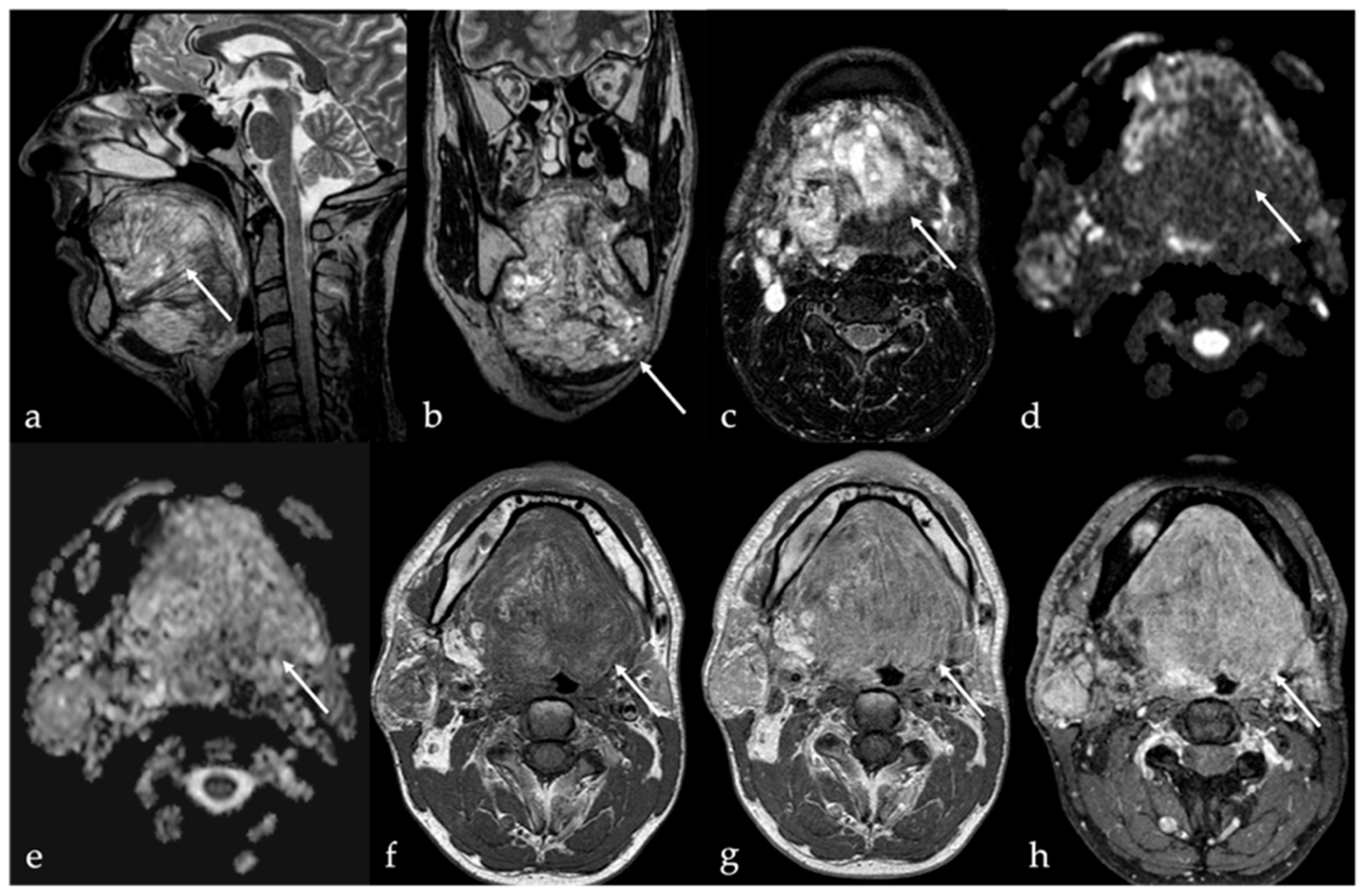 Cancers 17 01695 g006