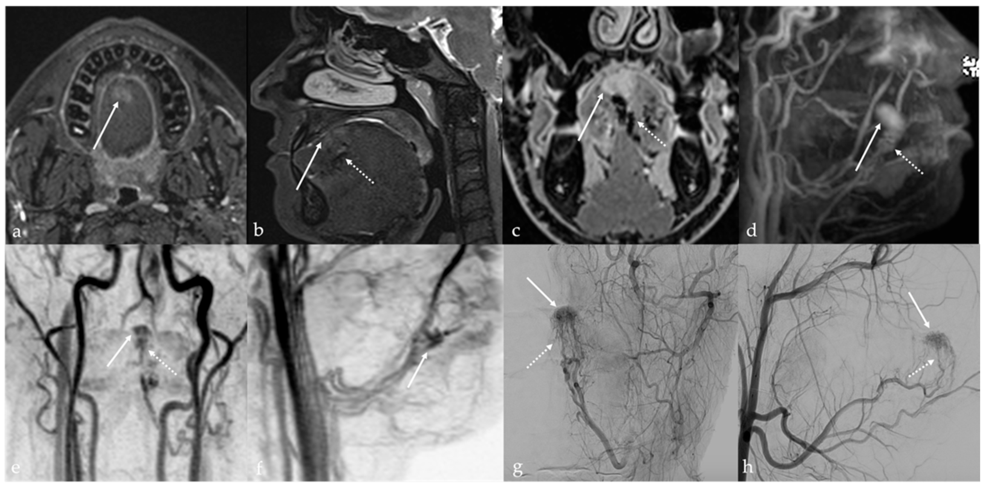 Cancers 17 01695 g007