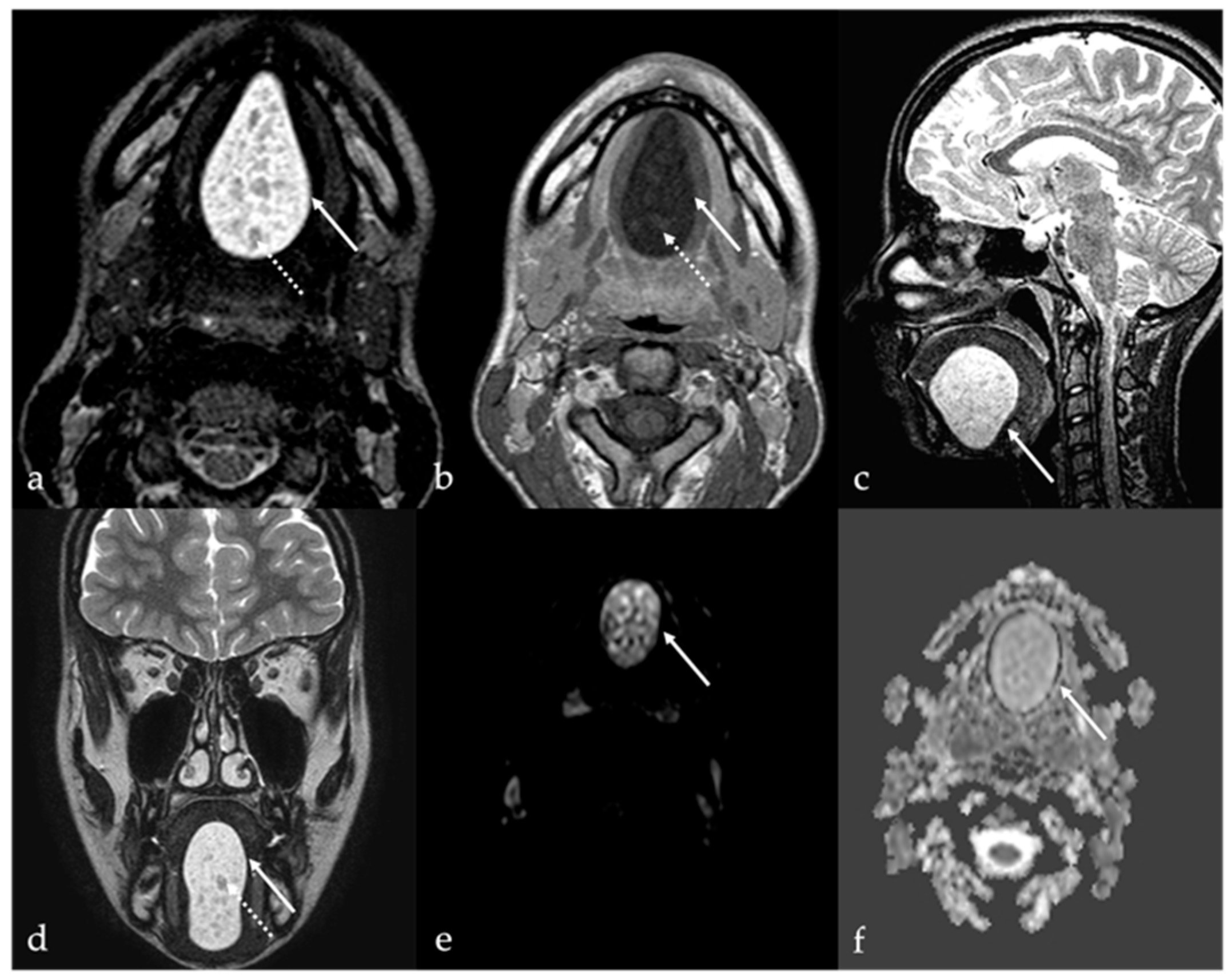 Cancers 17 01695 g008