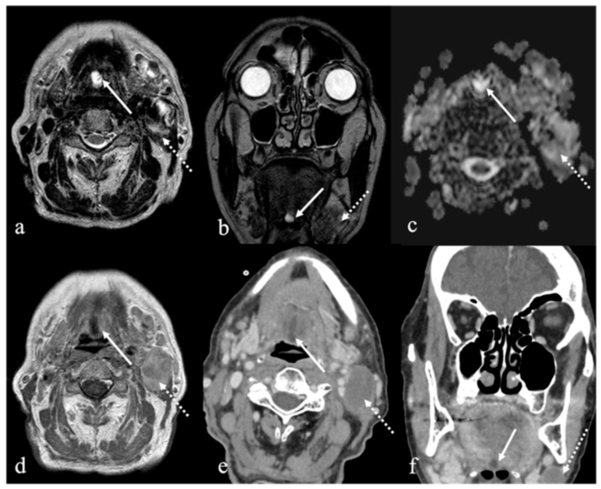 Cancers 17 01695 g010