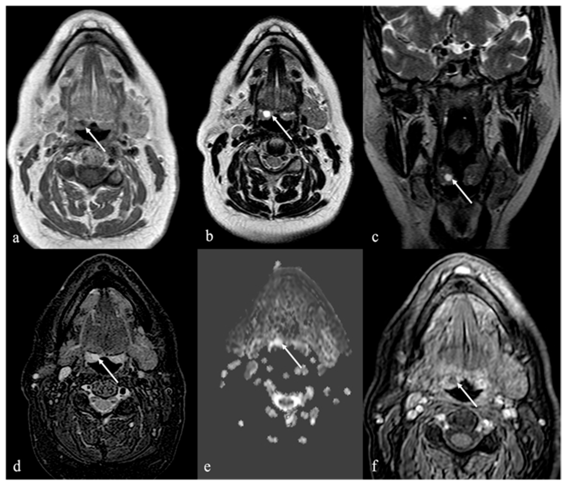Cancers 17 01695 g011