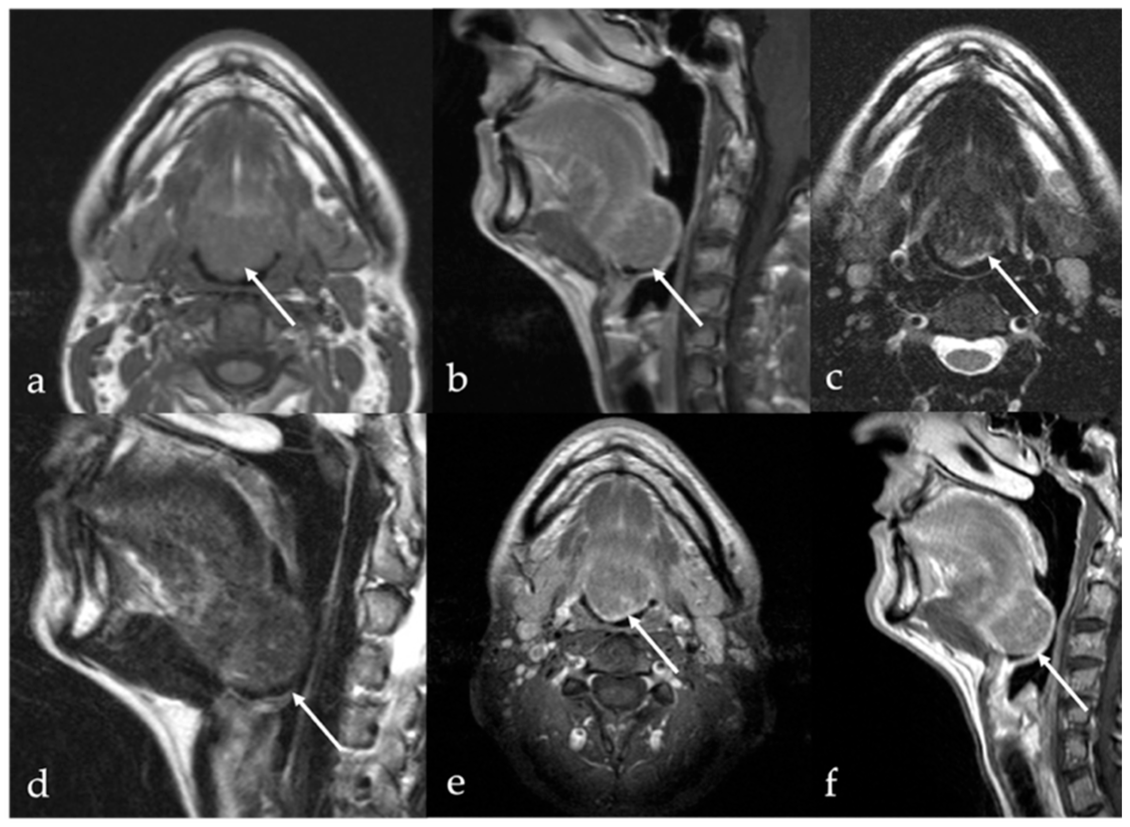 Cancers 17 01695 g012