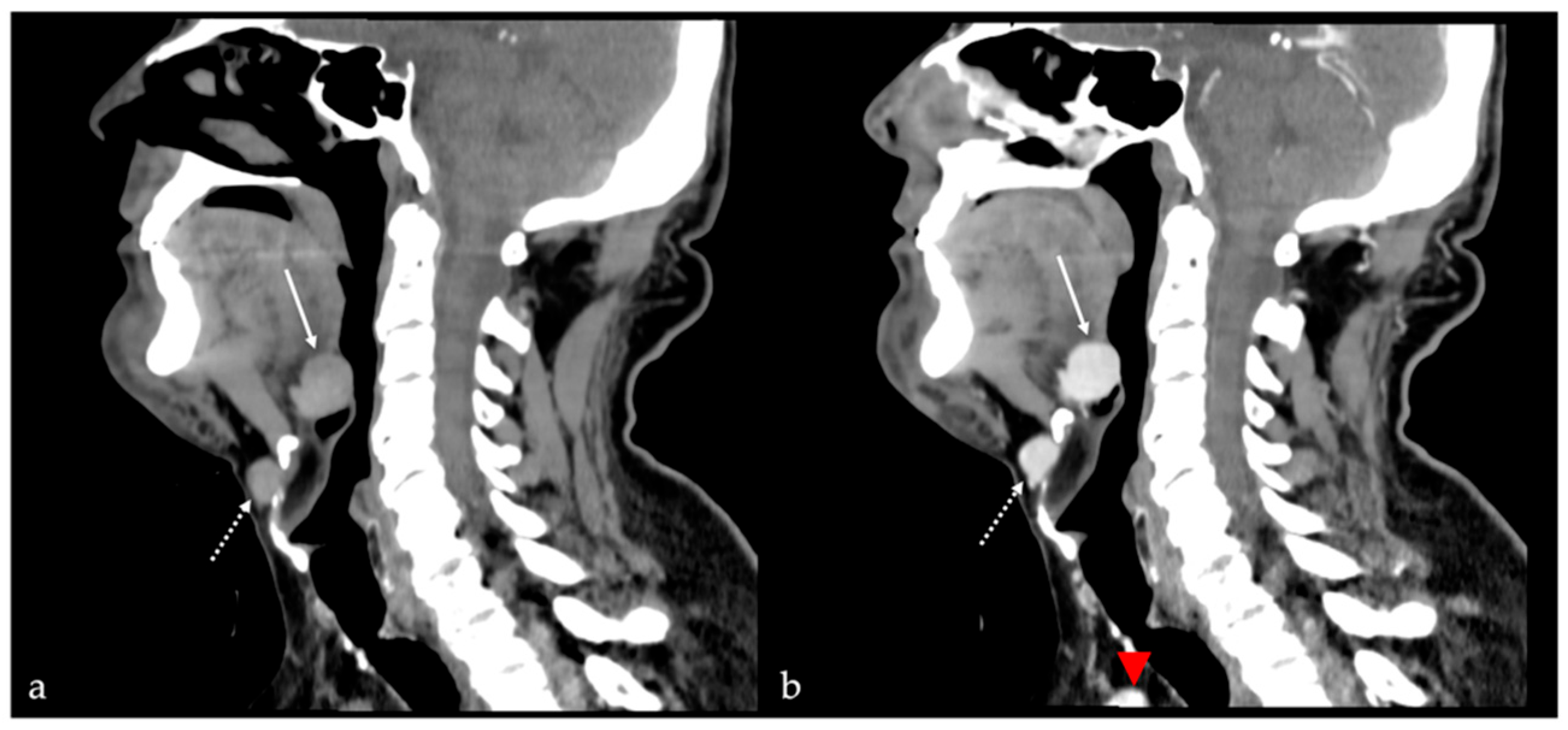 Cancers 17 01695 g013