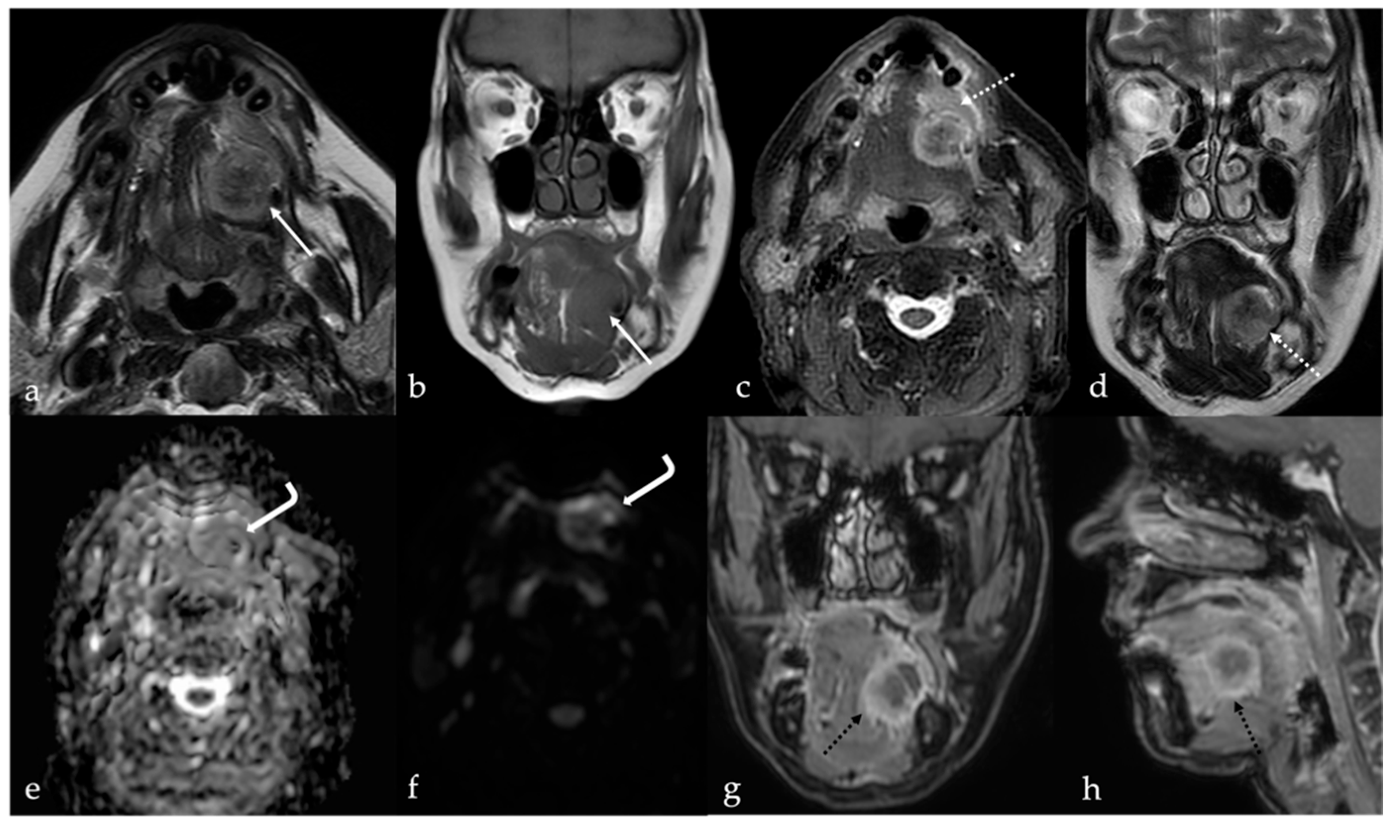 Cancers 17 01695 g014