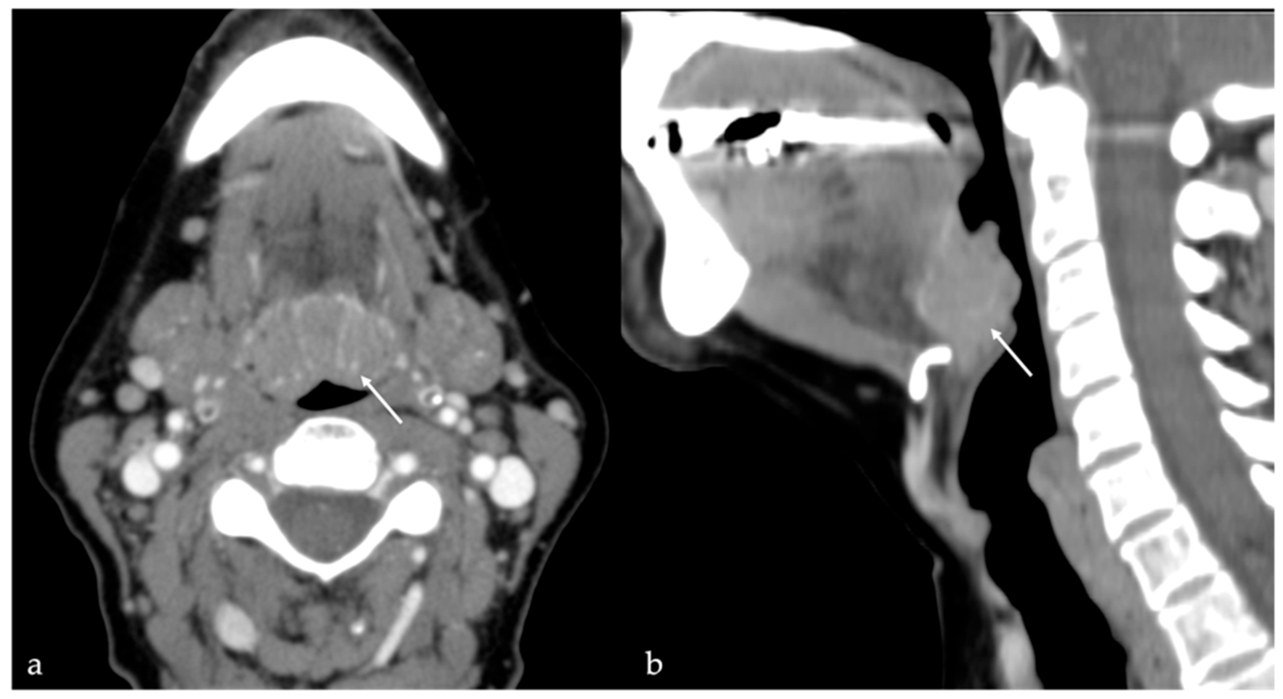 Cancers 17 01695 g015