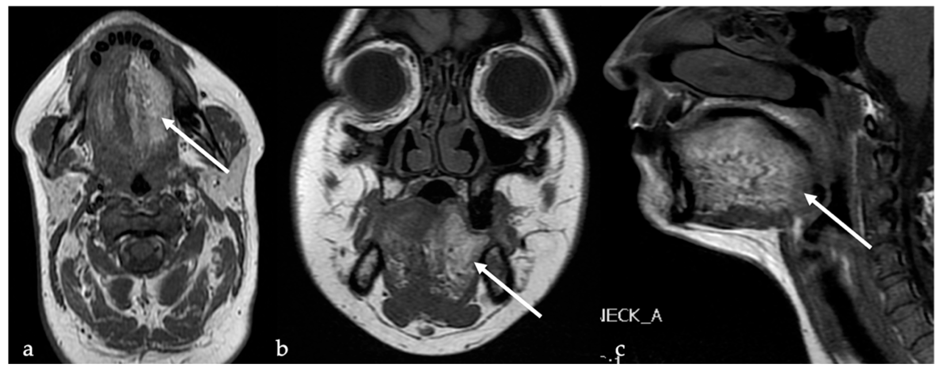 Cancers 17 01695 g016