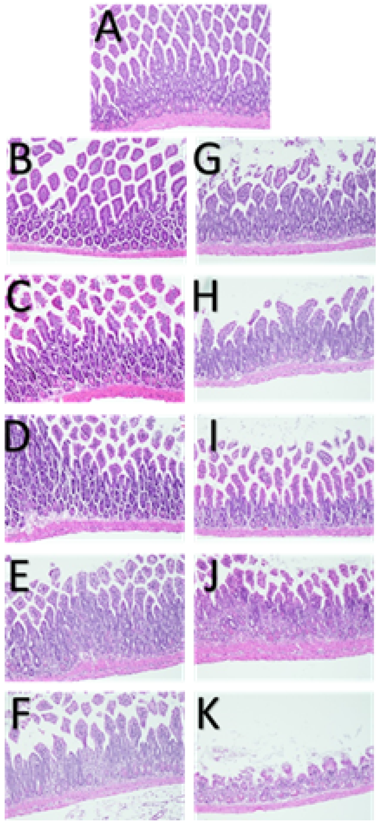Cancers 17 01701 g002