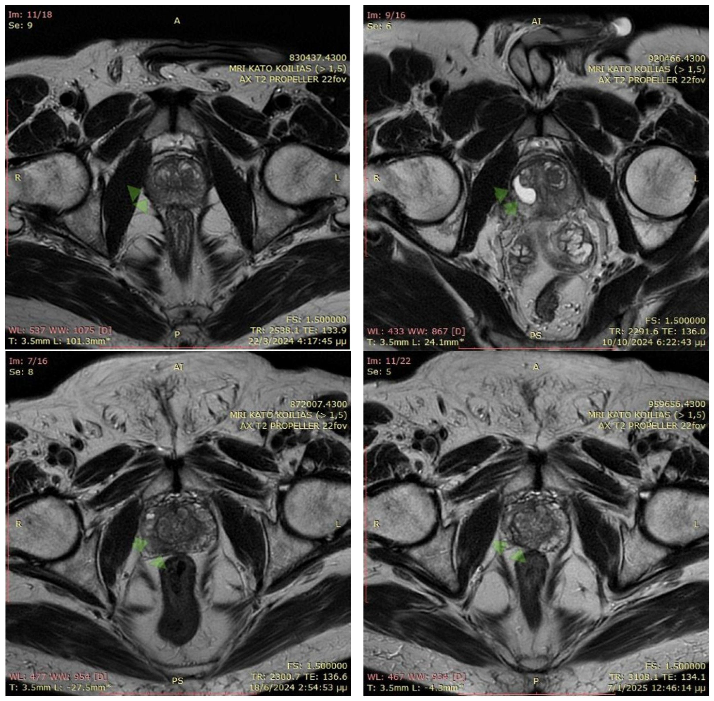 Cancers 17 01707 g001