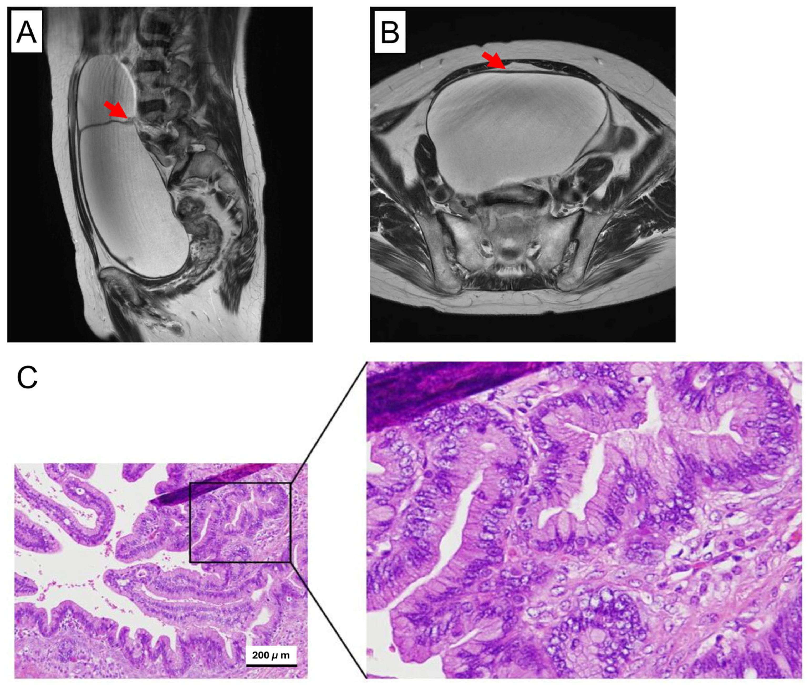 Cancers 17 01716 g001