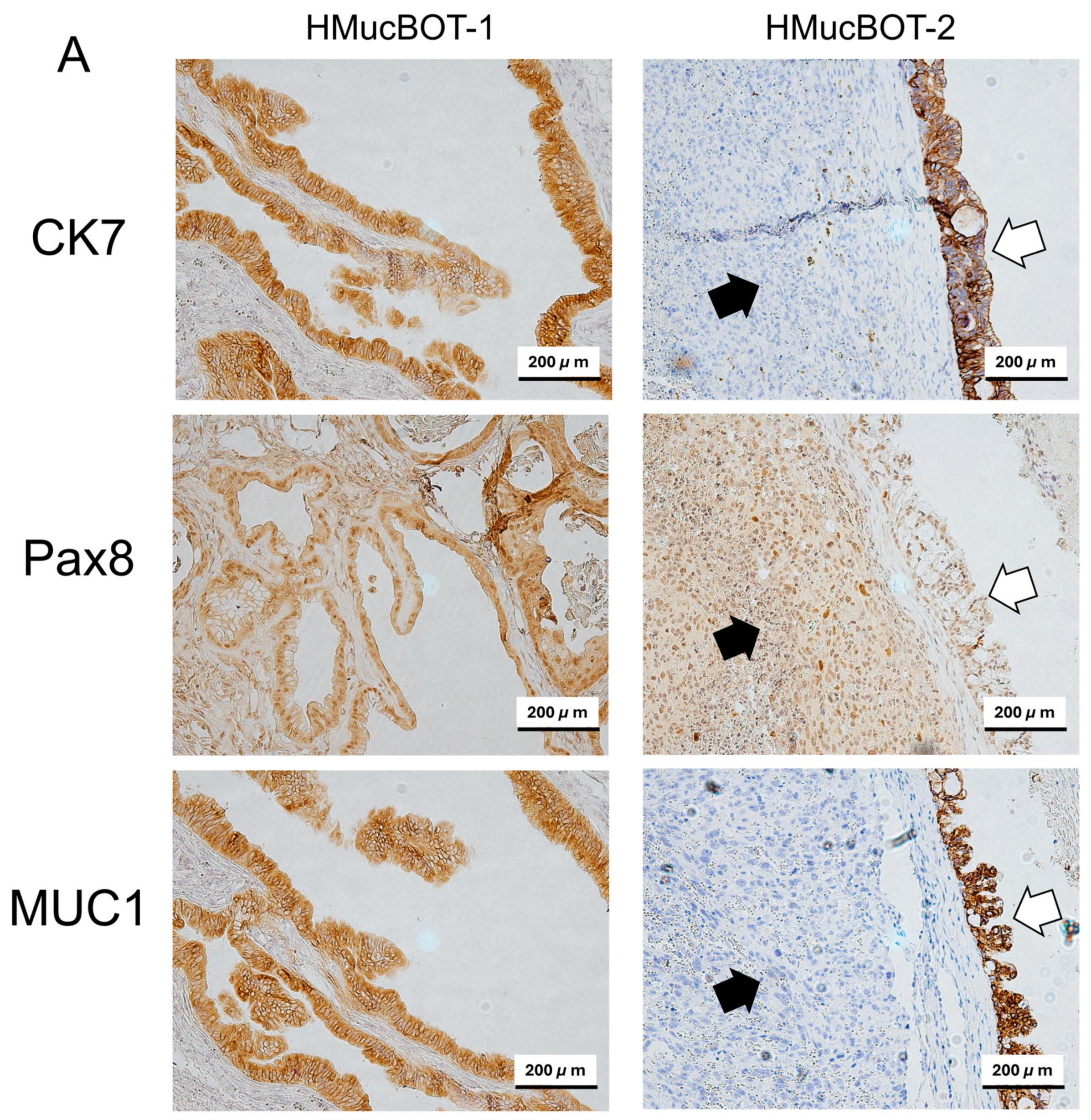 Cancers 17 01716 g006a
