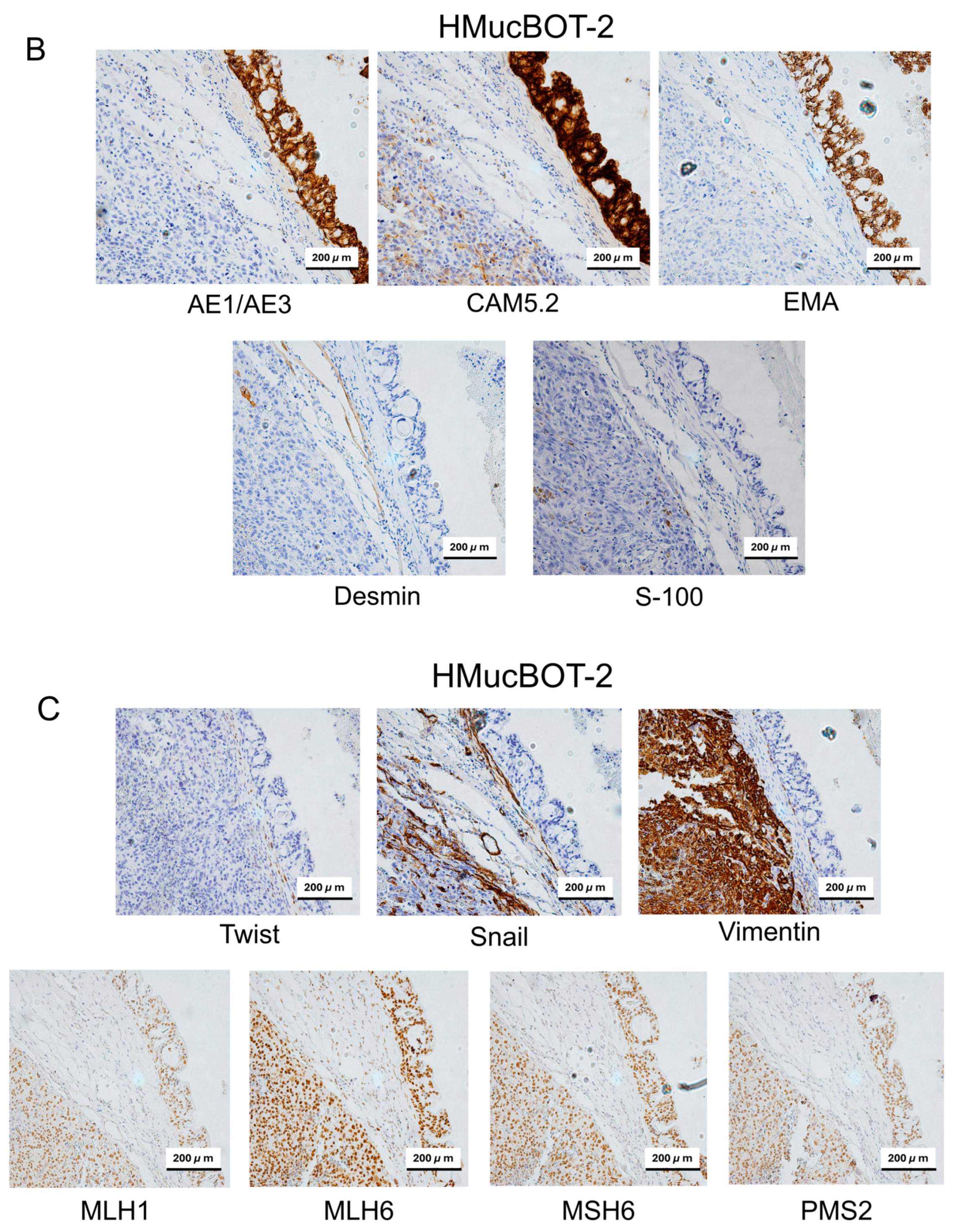 Cancers 17 01716 g006b