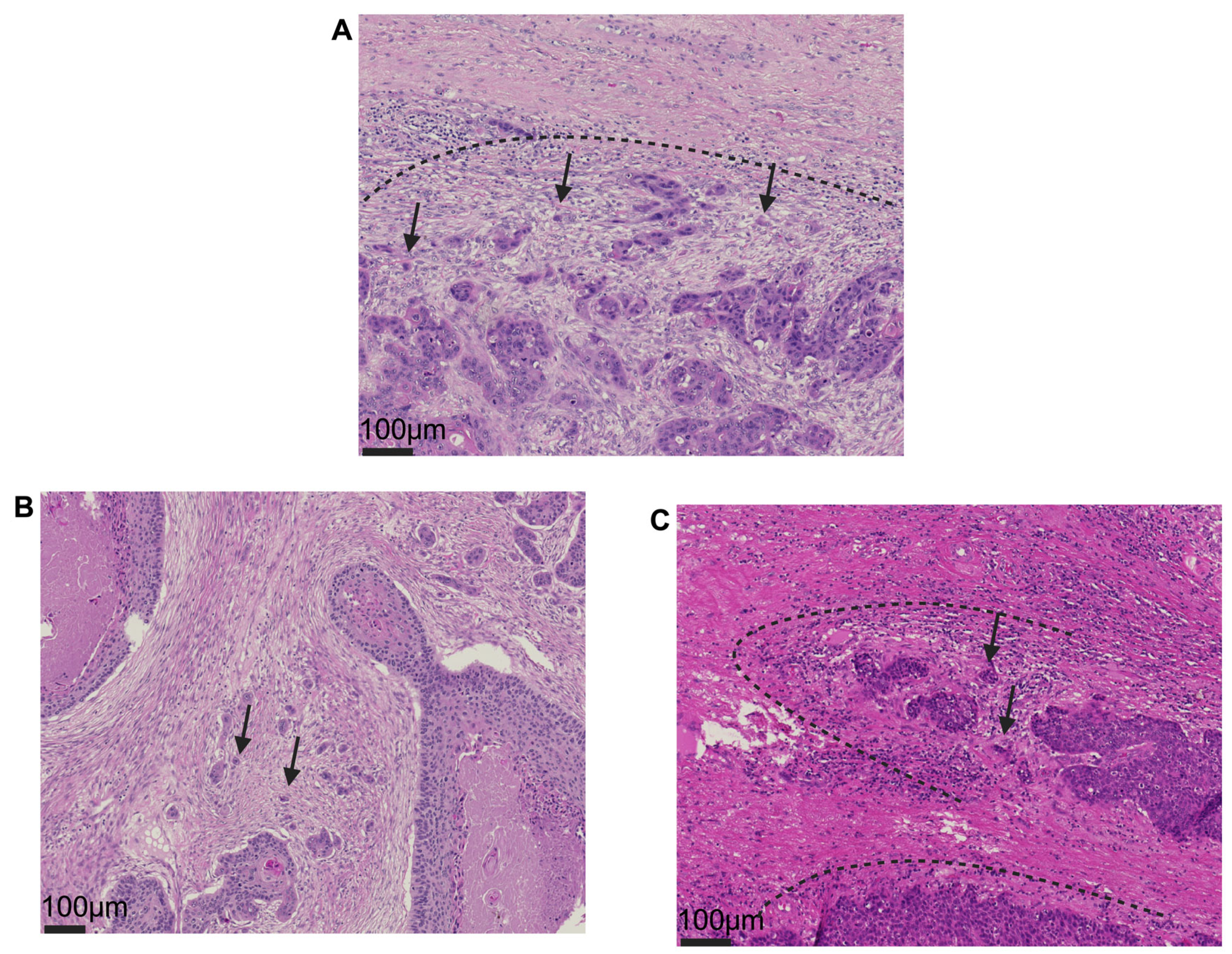 Cancers 17 01718 g001