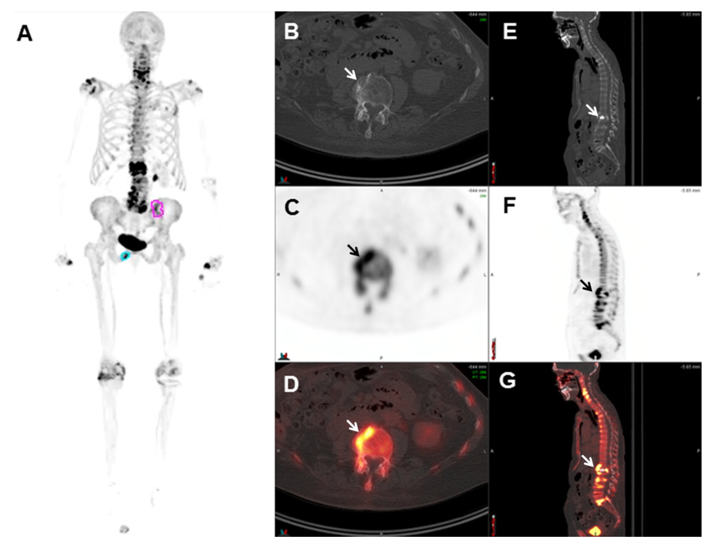 Cancers 17 01723 g001 Cancers 17 01723 g001