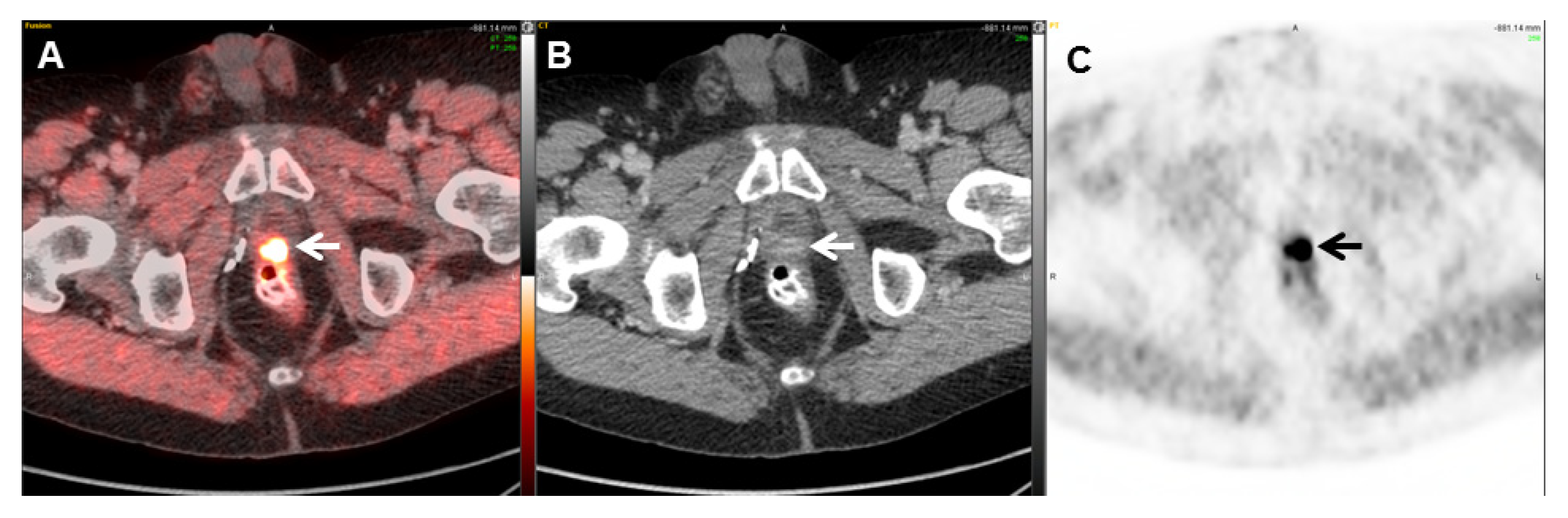 Cancers 17 01723 g002 Cancers 17 01723 g002