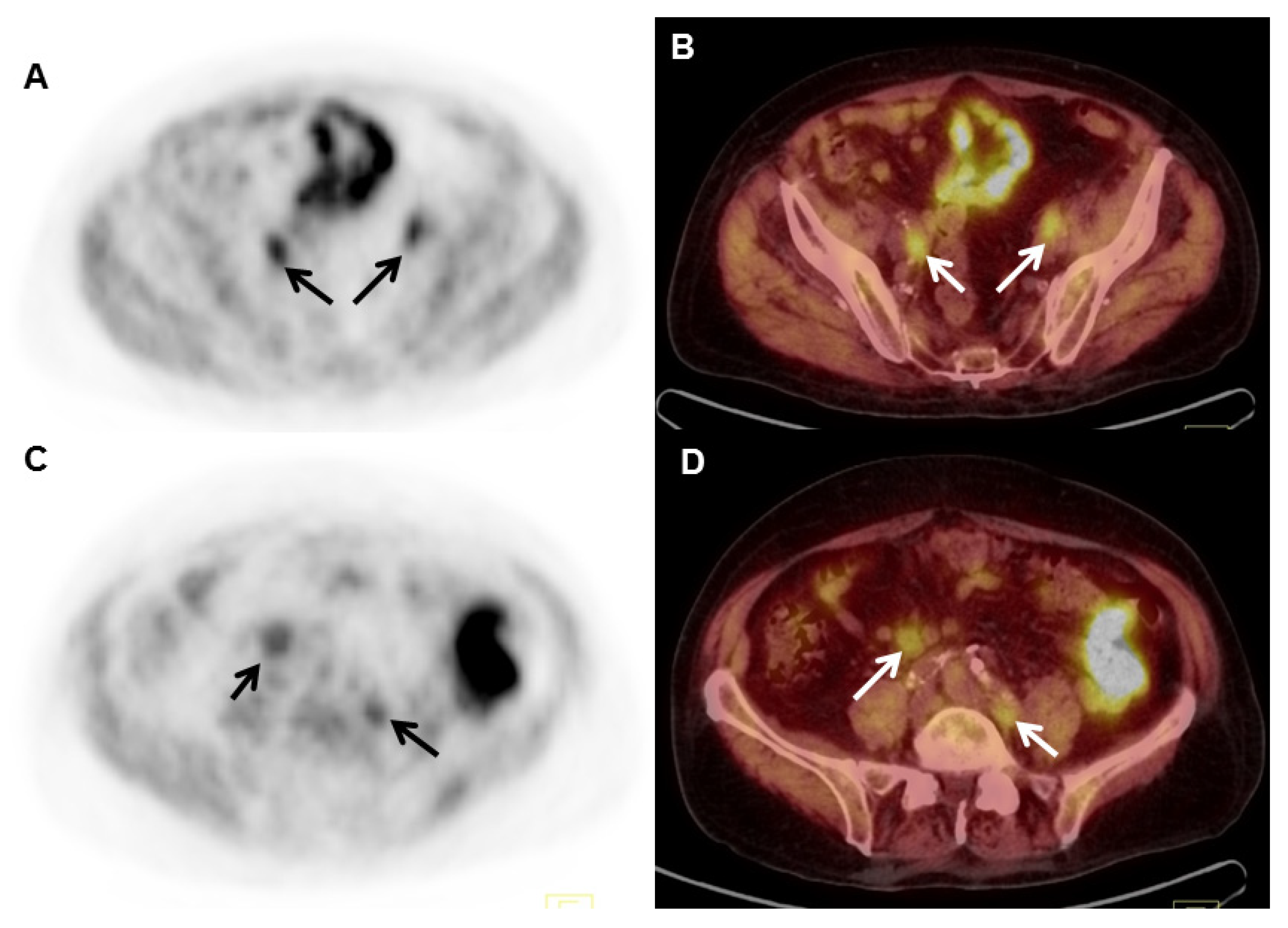 Cancers 17 01723 g003 Cancers 17 01723 g003