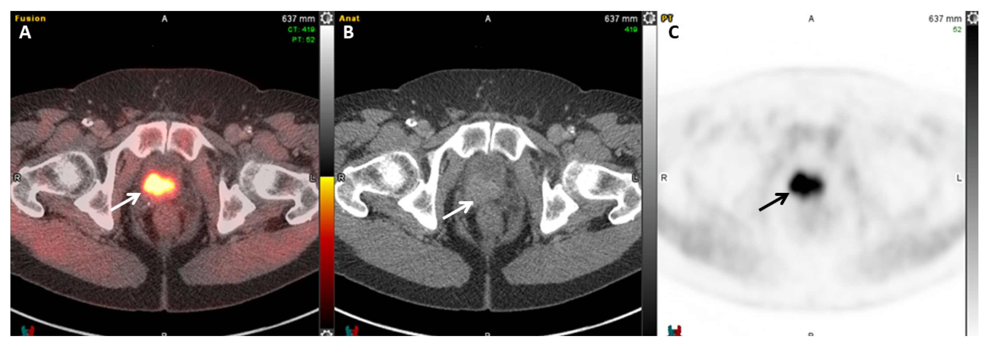 Cancers 17 01723 g004 Cancers 17 01723 g004