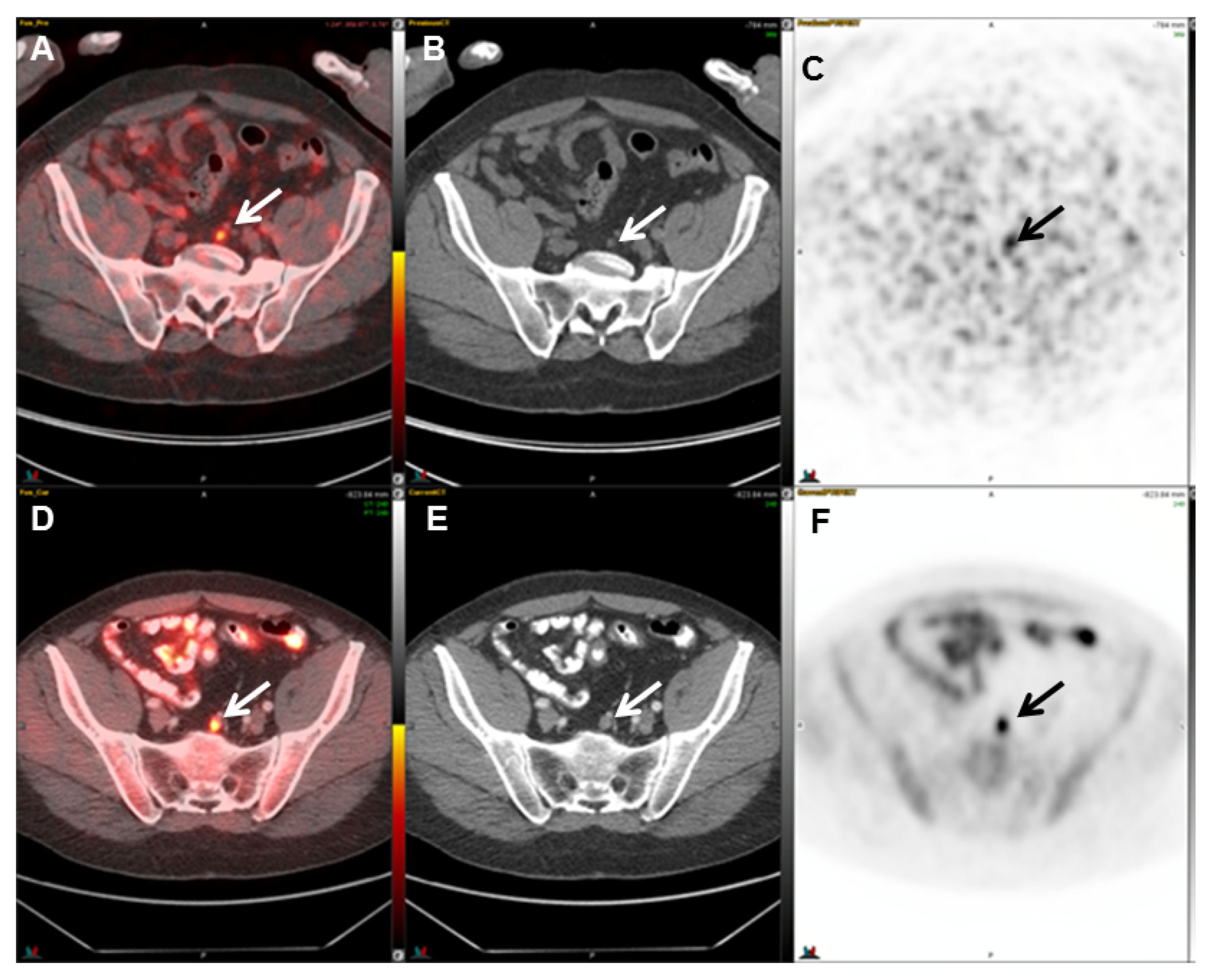 Cancers 17 01723 g005 Cancers 17 01723 g005