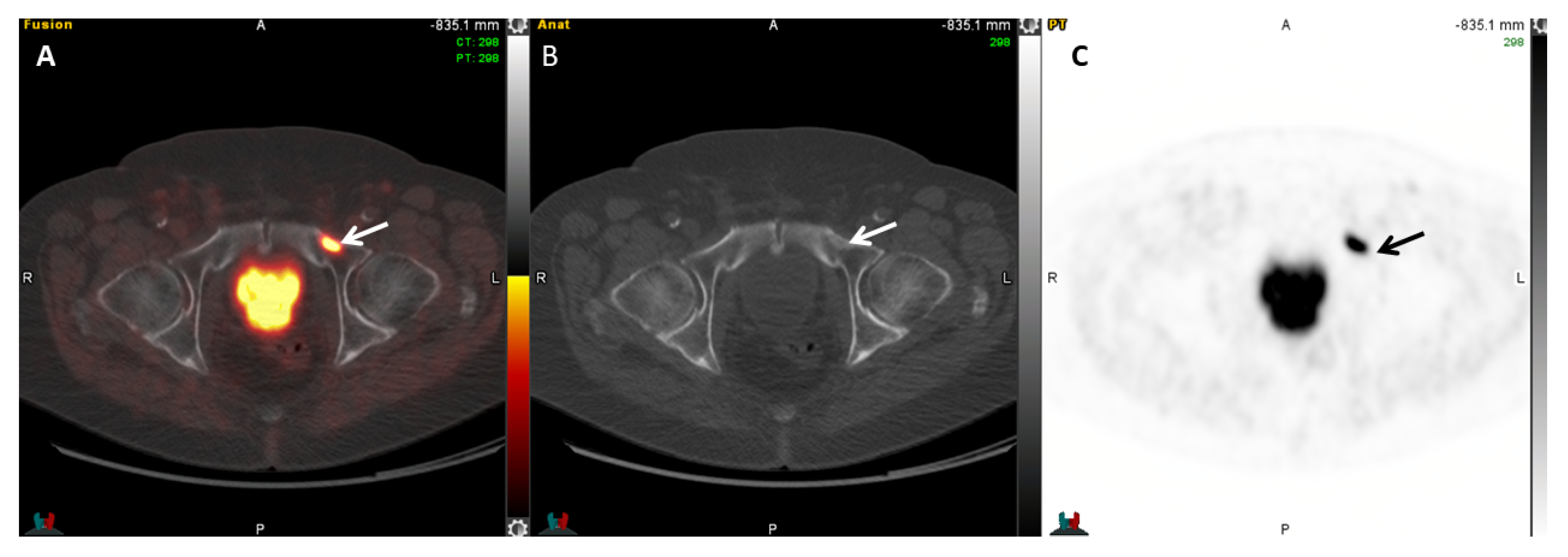 Cancers 17 01723 g006 Cancers 17 01723 g006