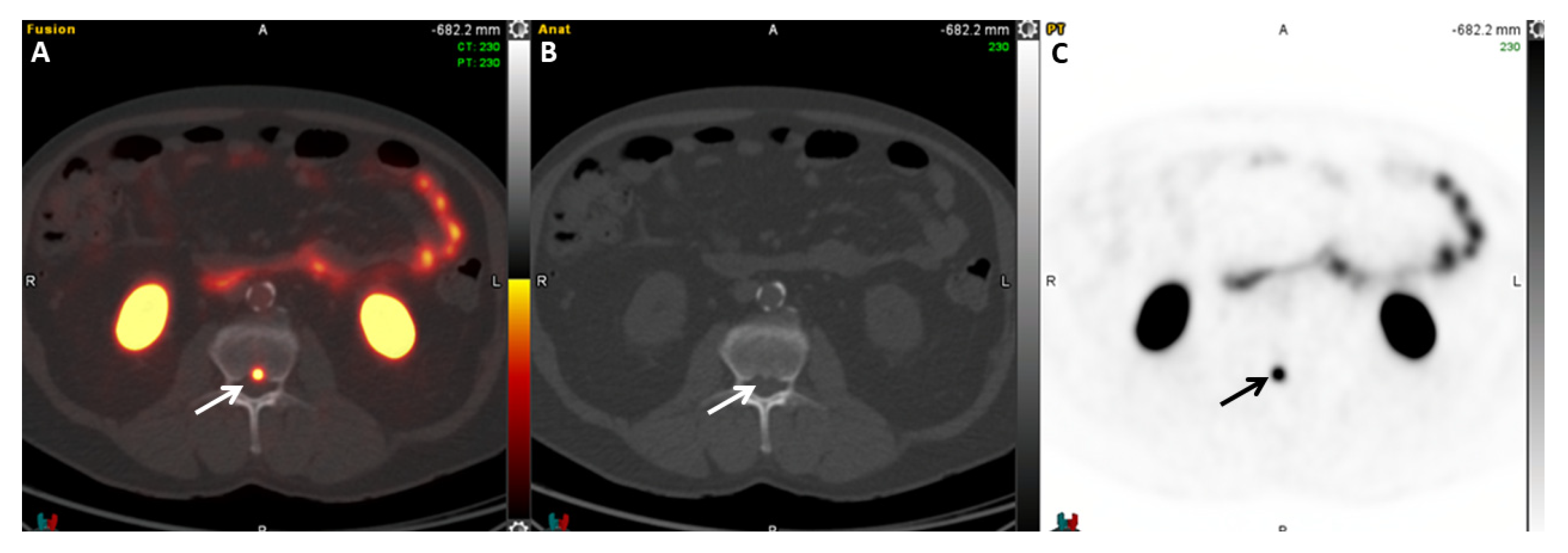 Cancers 17 01723 g007 Cancers 17 01723 g007