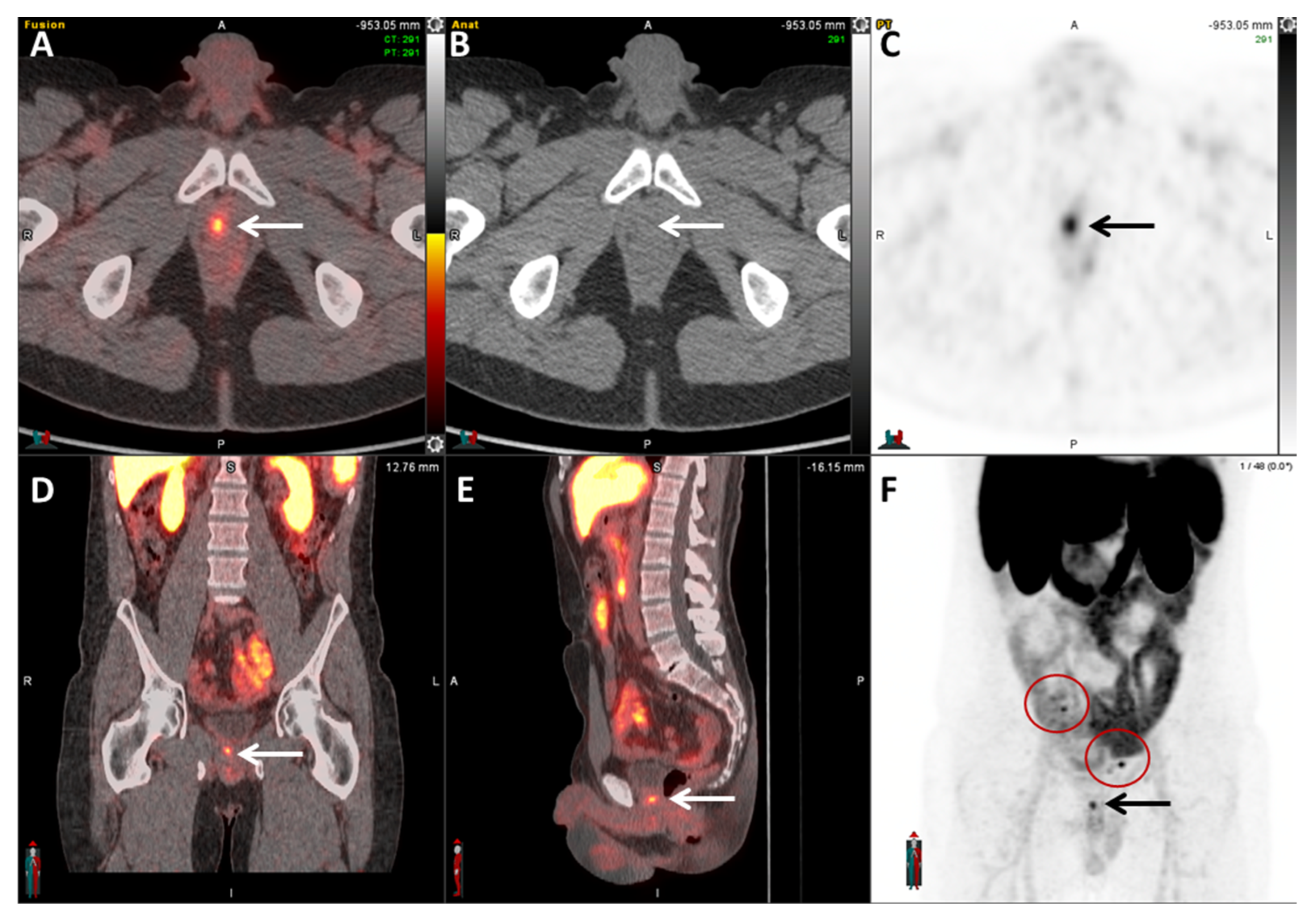 Cancers 17 01723 g008 Cancers 17 01723 g008