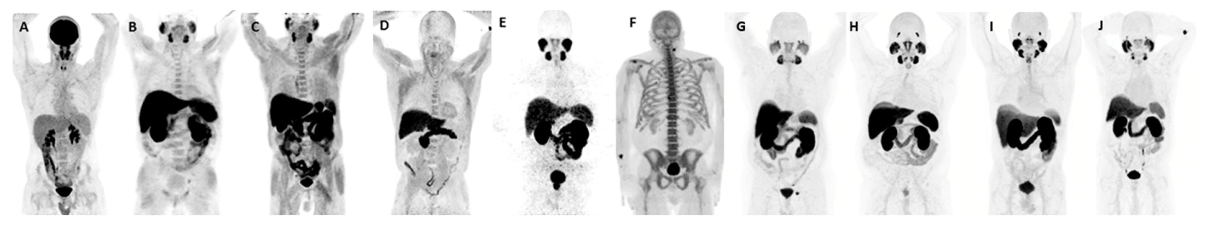 Cancers 17 01723 g009 Cancers 17 01723 g009