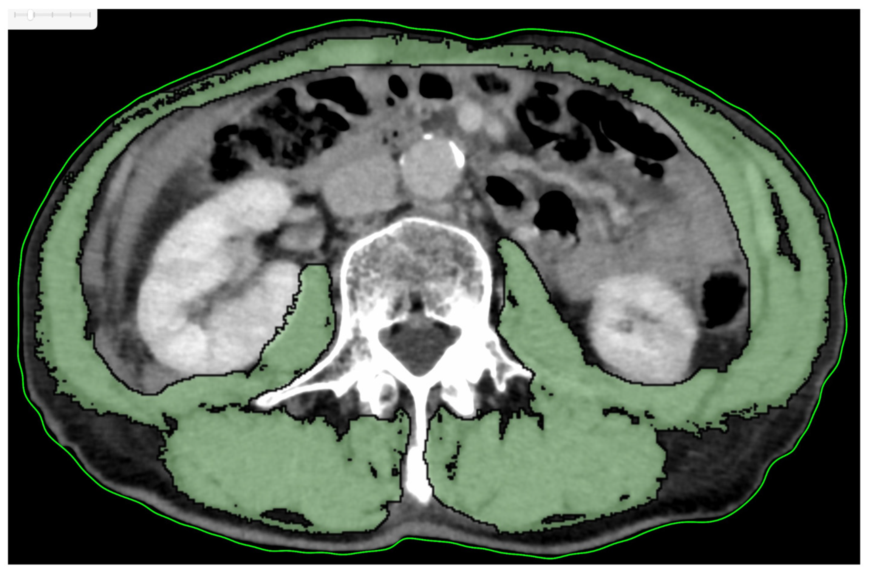 Cancers 17 01729 g001