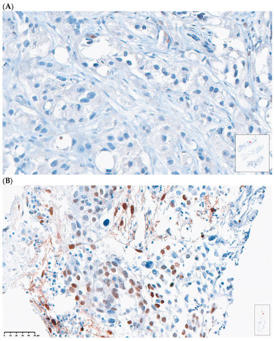 Immune Modulation During Treatment with Enzalutamide Alone or with