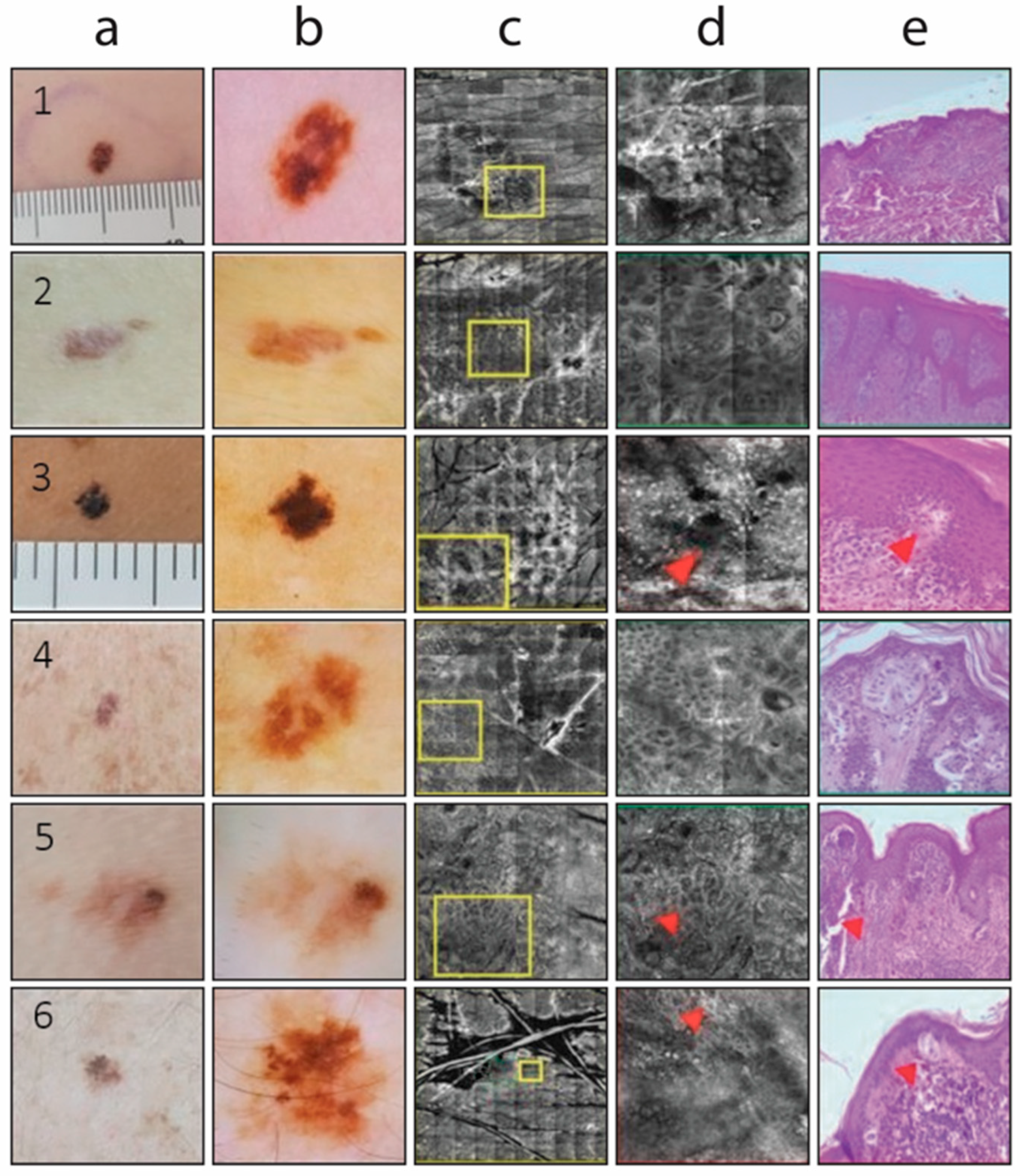 Cancers 17 01745 g001