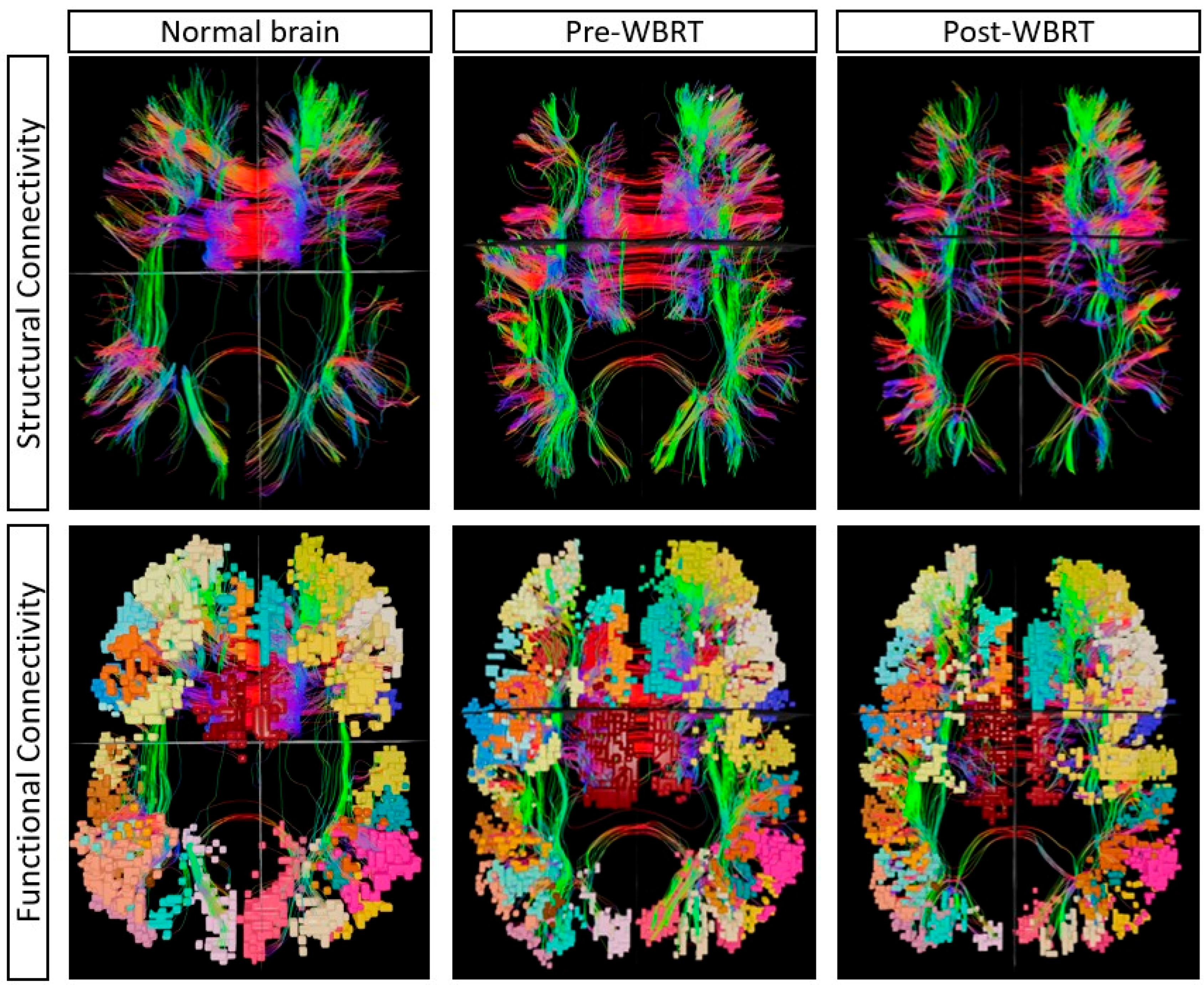 Cancers 17 01752 g003
