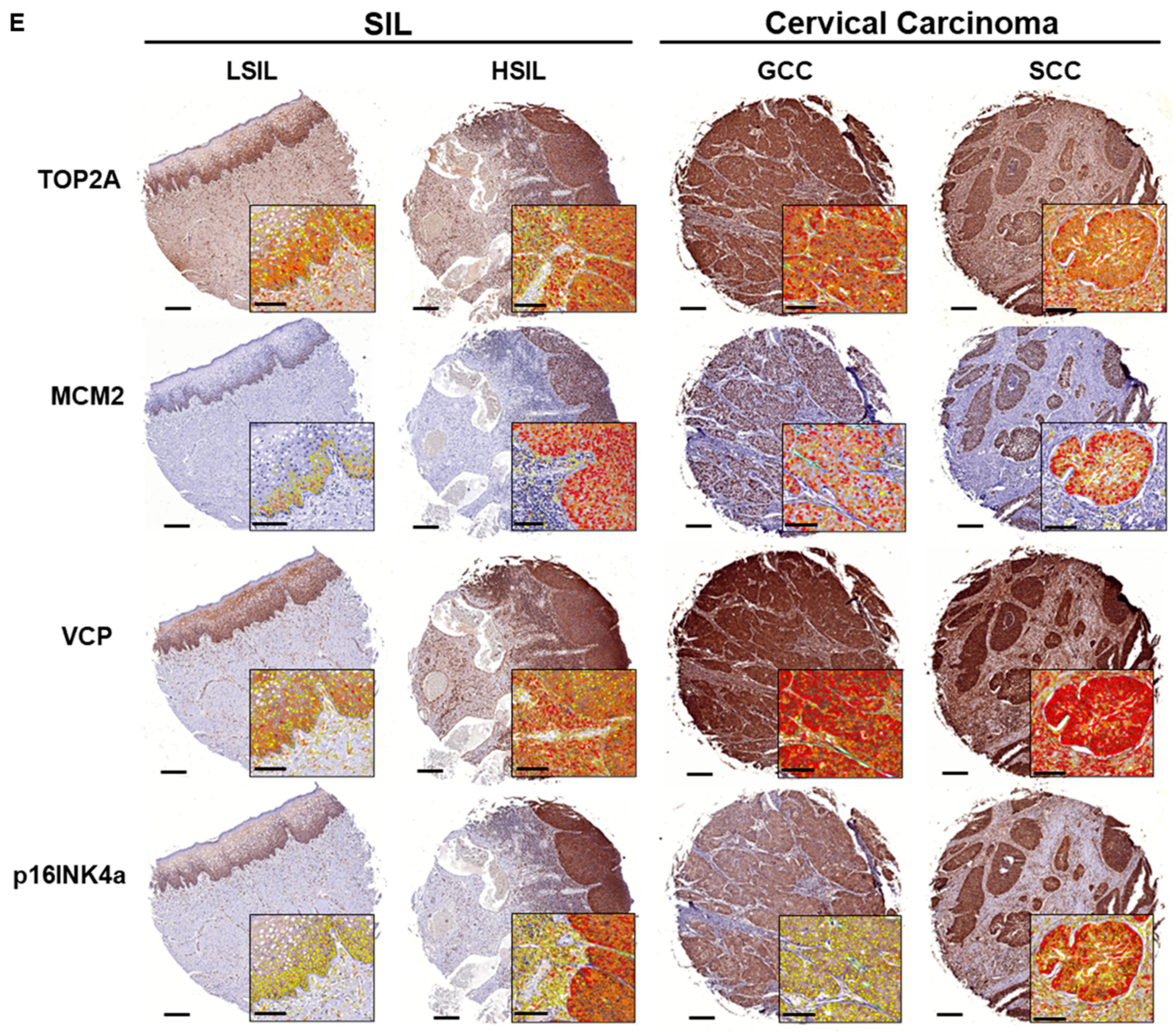 Cancers 17 01763 g006b Cancers 17 01763 g006b