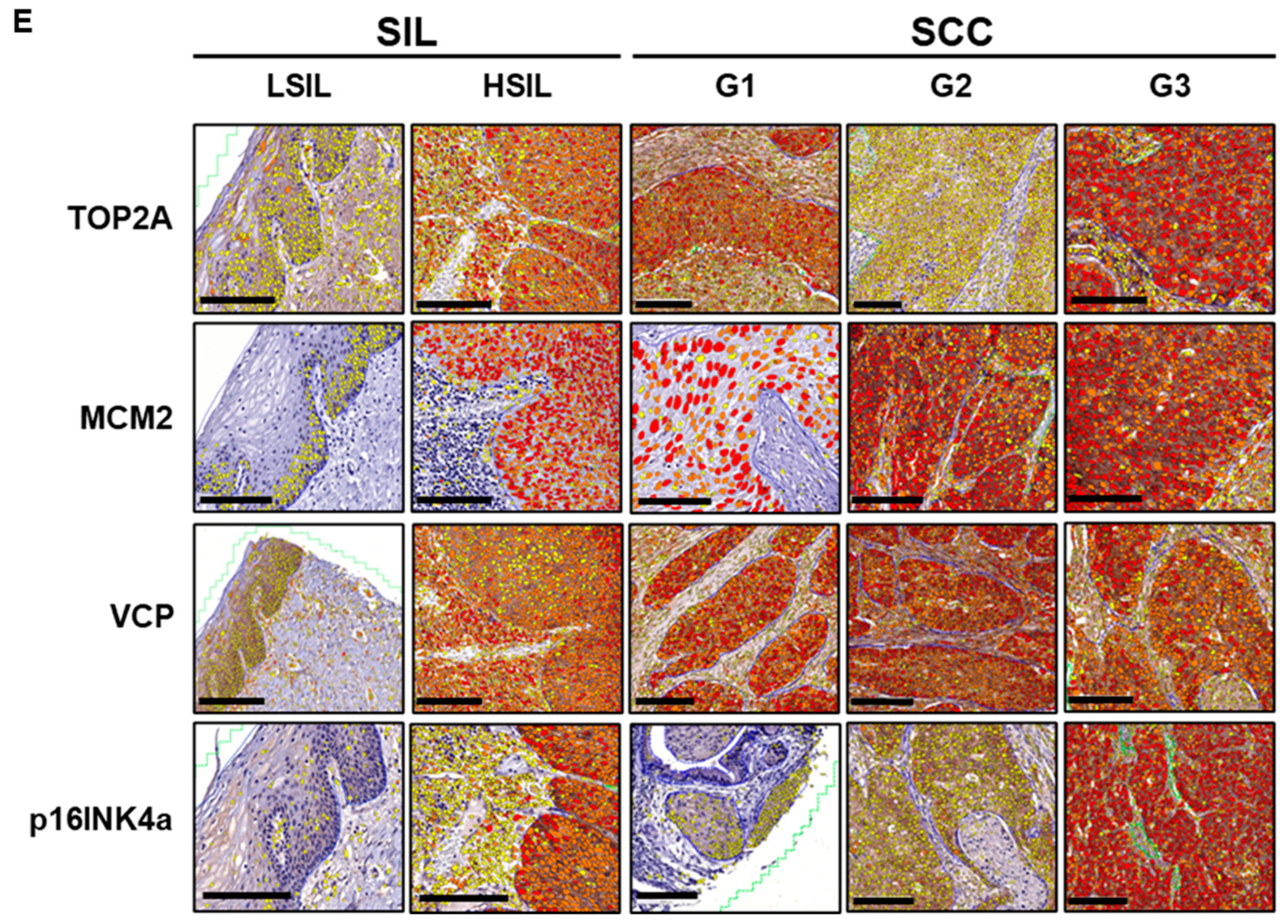 Cancers 17 01763 g007b Cancers 17 01763 g007b