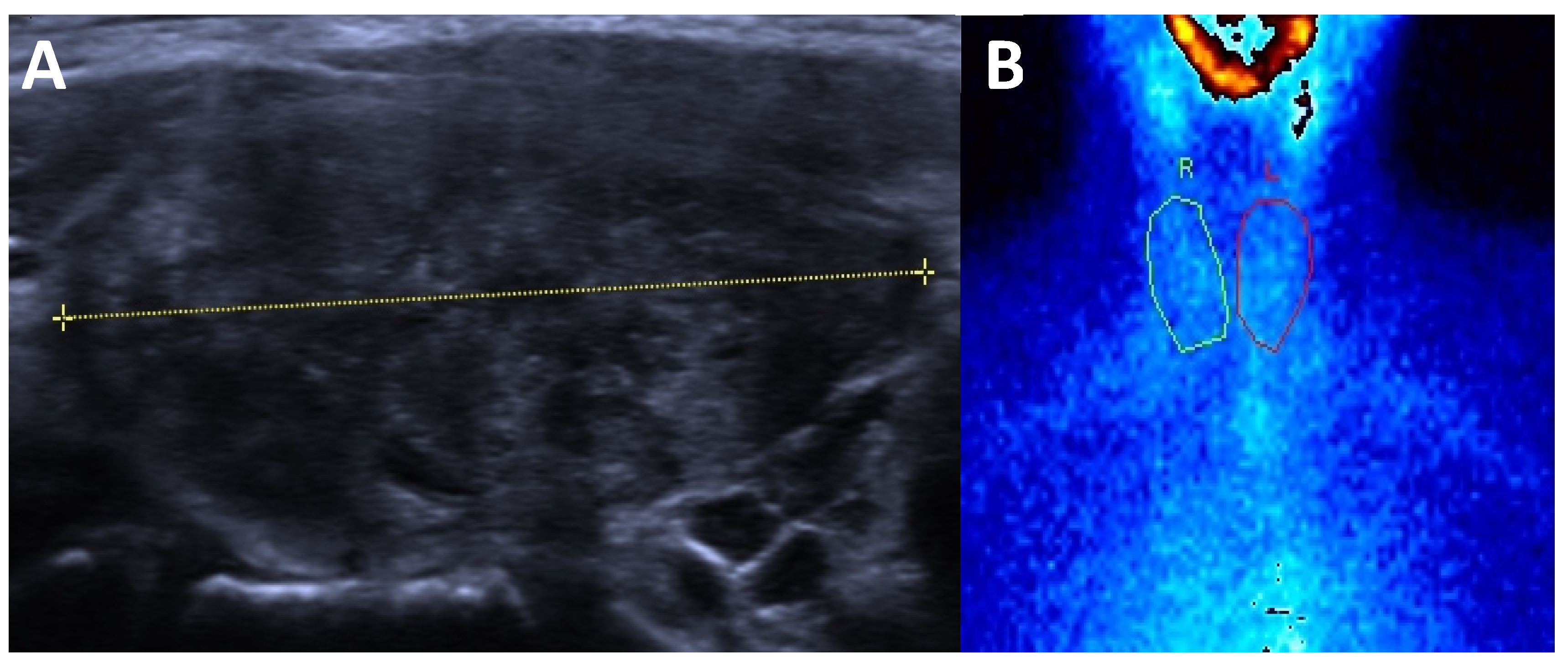 Cancers 17 01764 g003