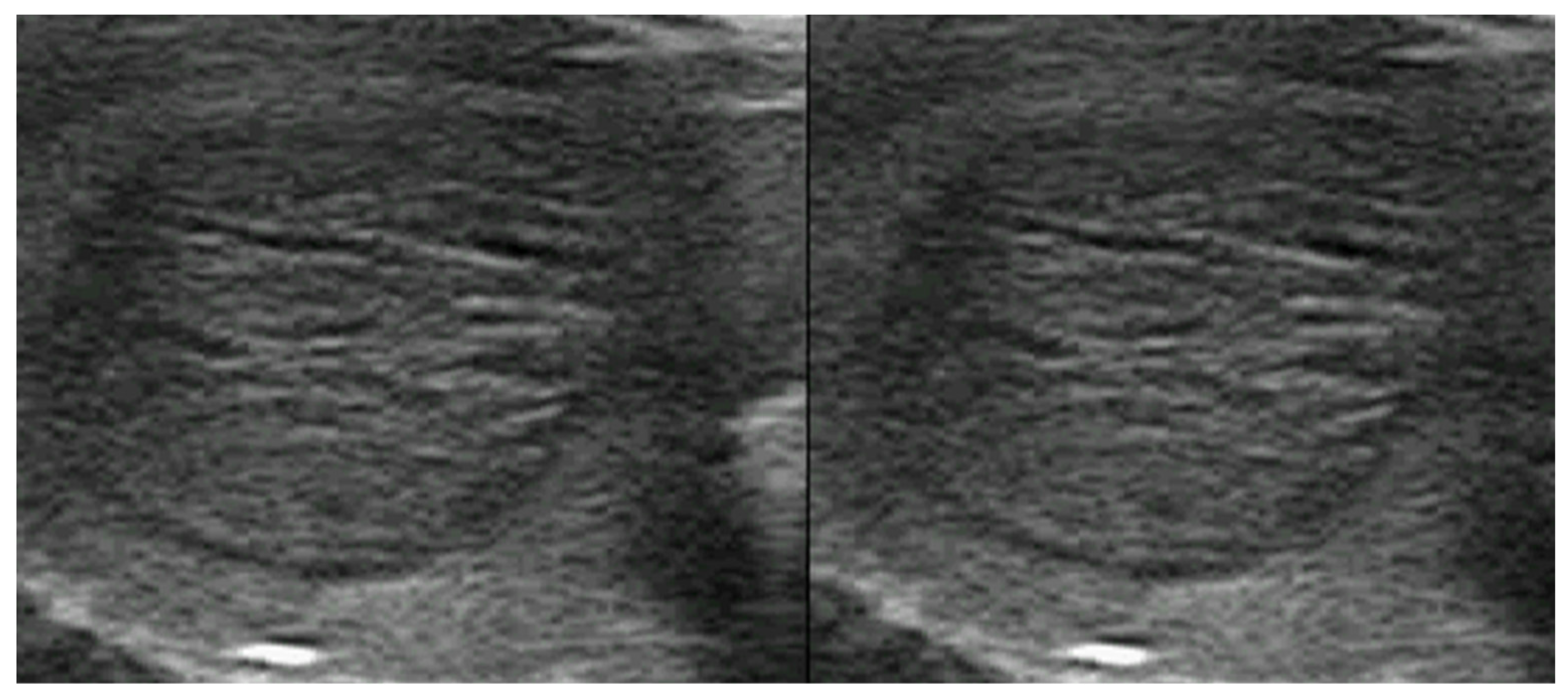 Cancers 17 01764 g004