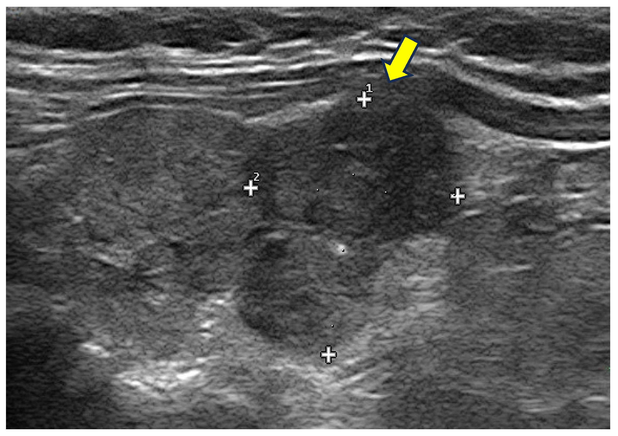 Cancers 17 01764 g005