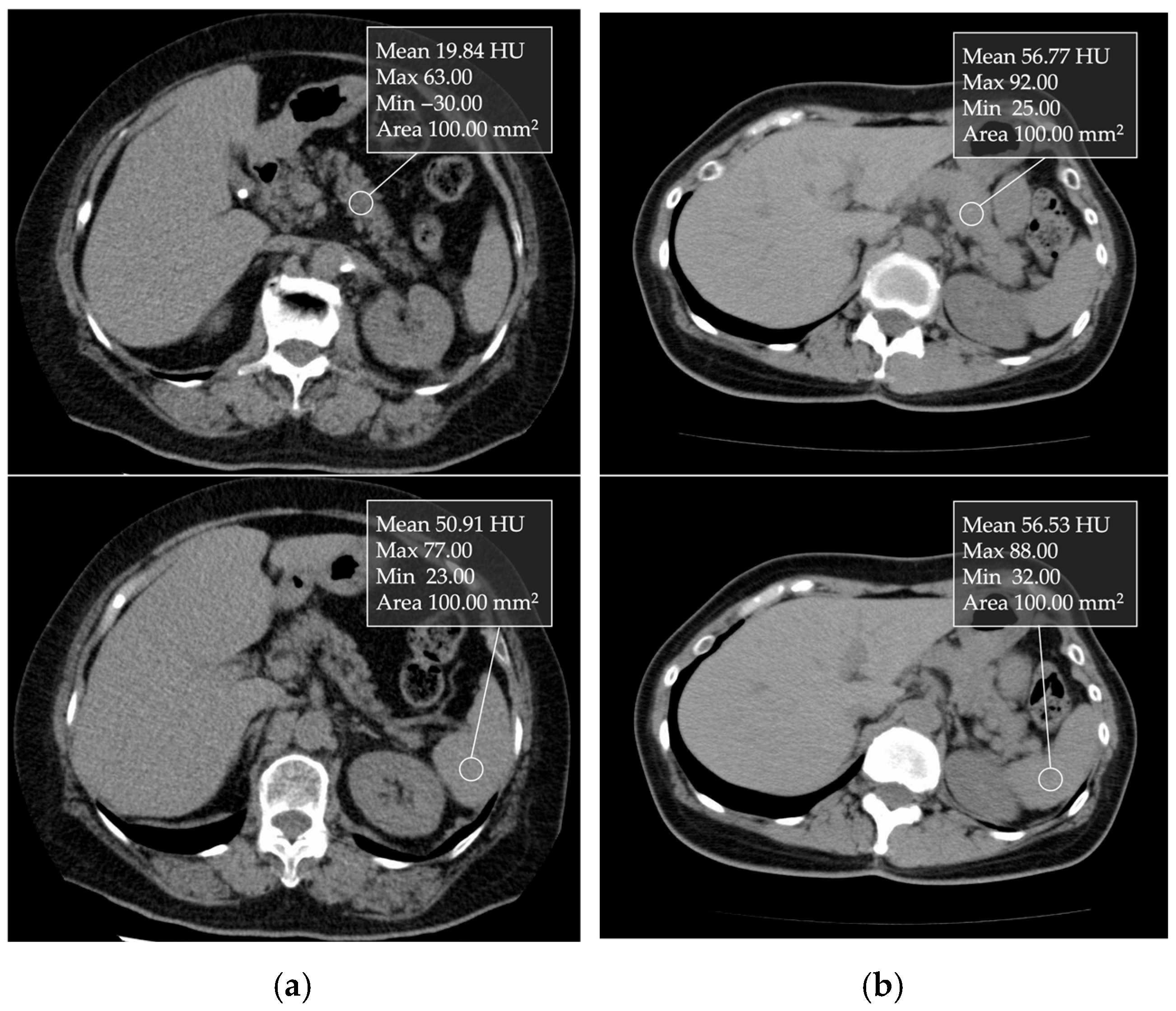 Cancers 17 01765 g004