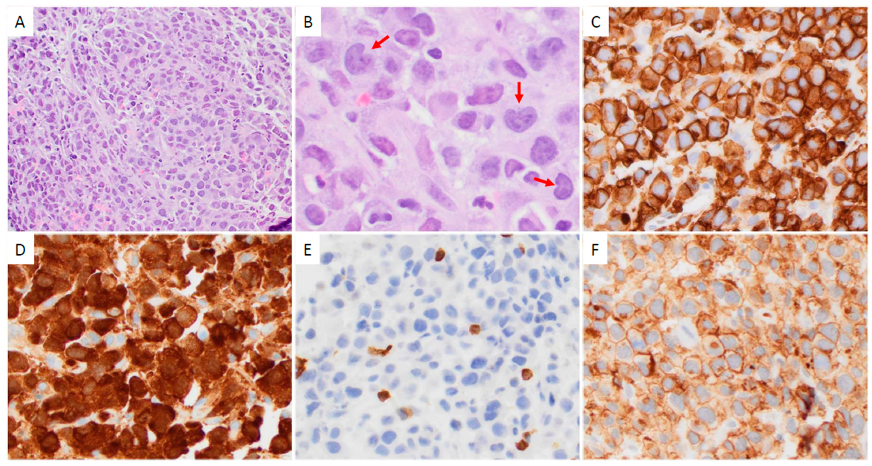 Cancers 17 01767 g001