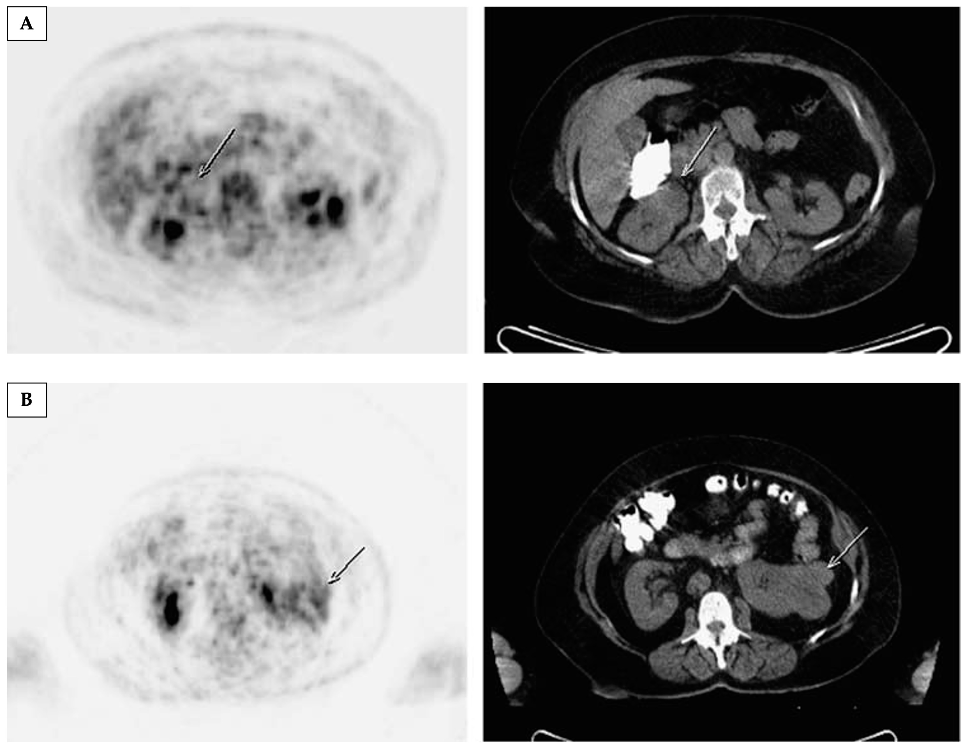 Cancers 17 01773 g001