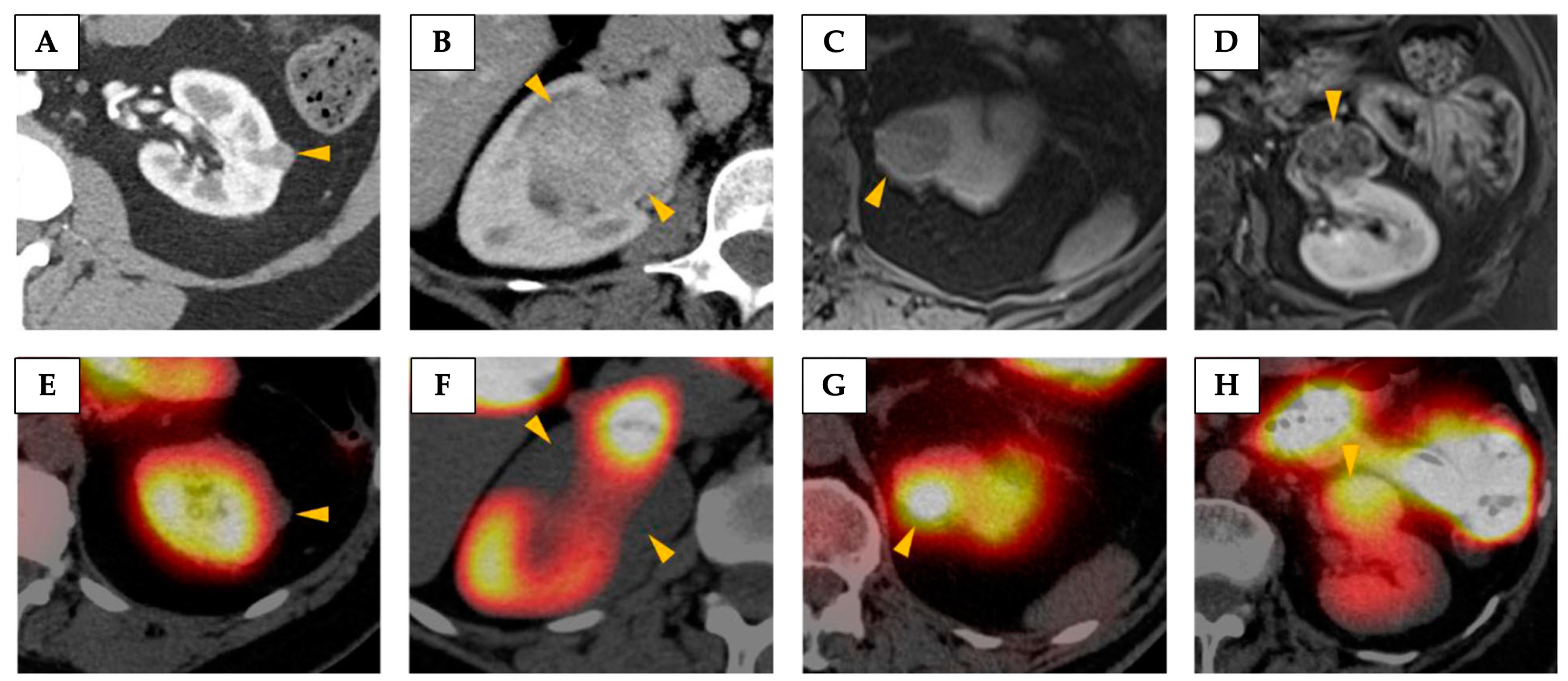 Cancers 17 01773 g002