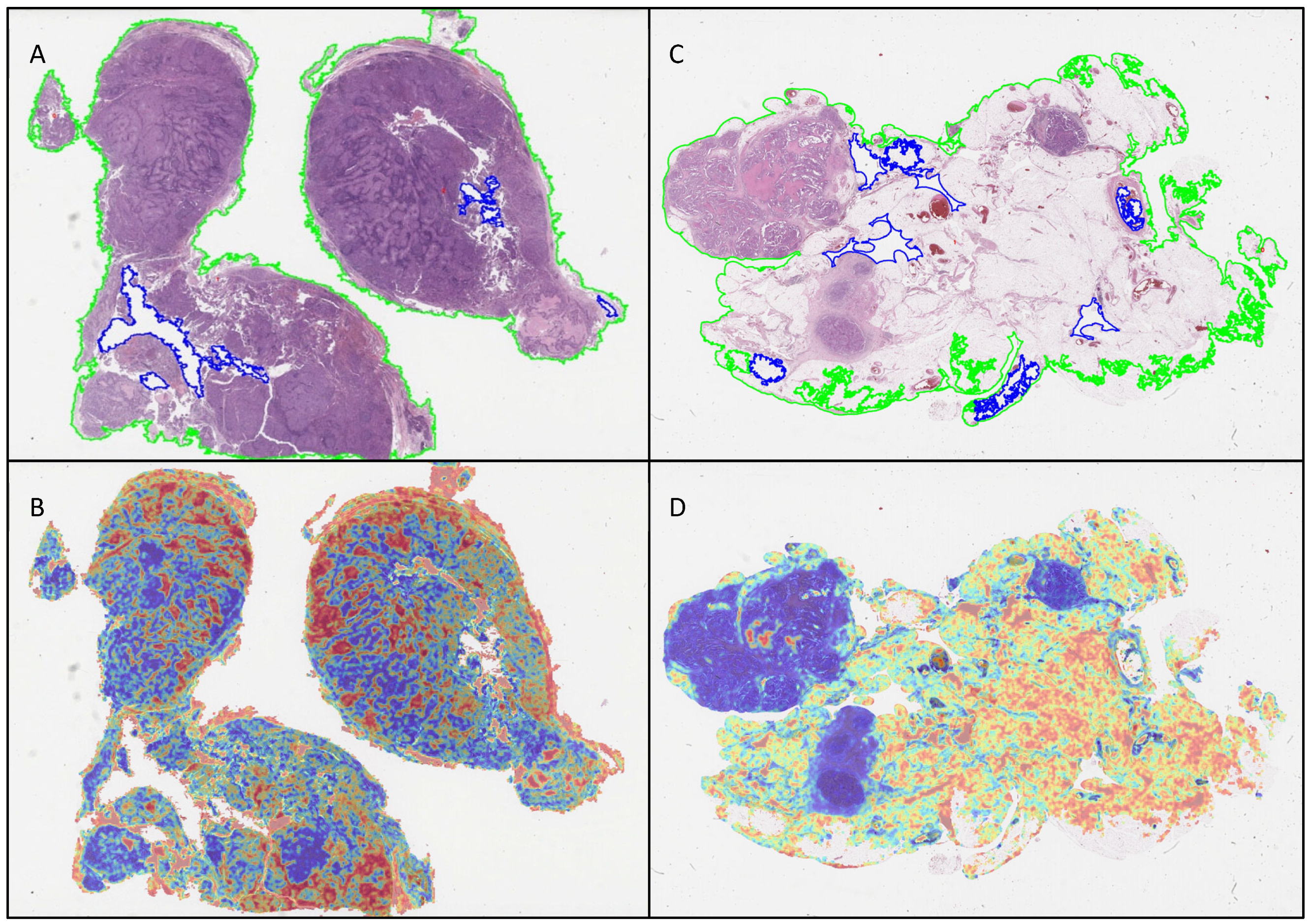 Cancers 17 01789 g004