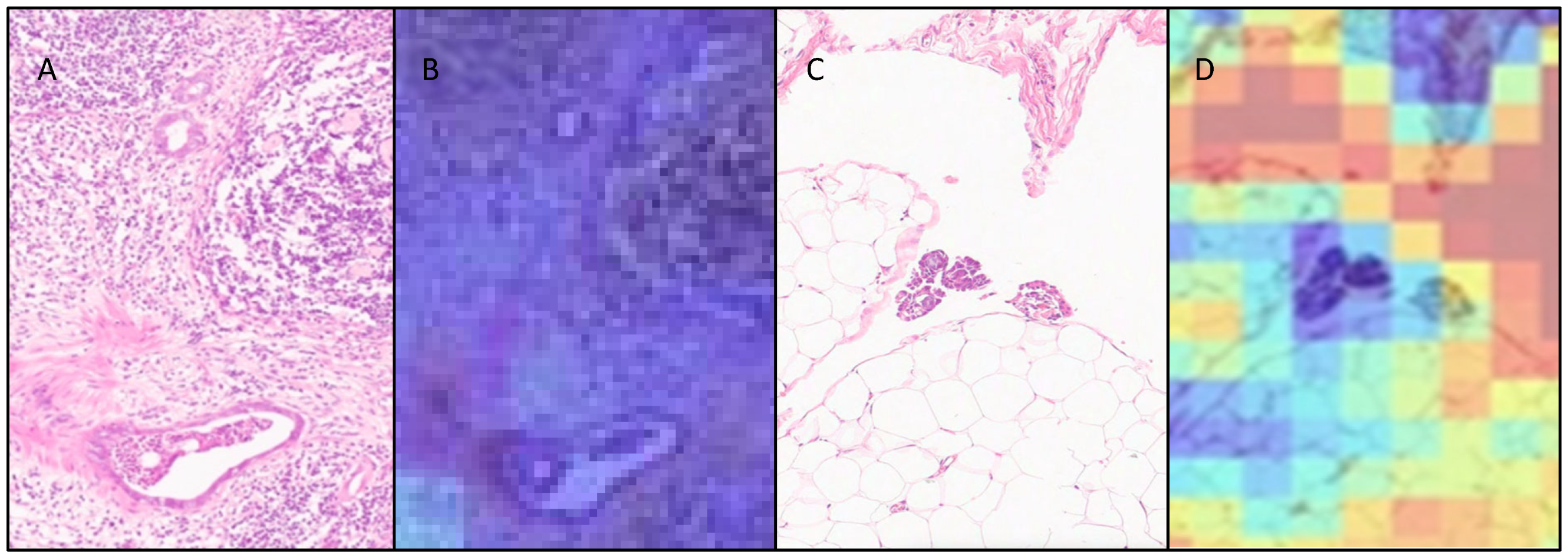 Cancers 17 01789 g005