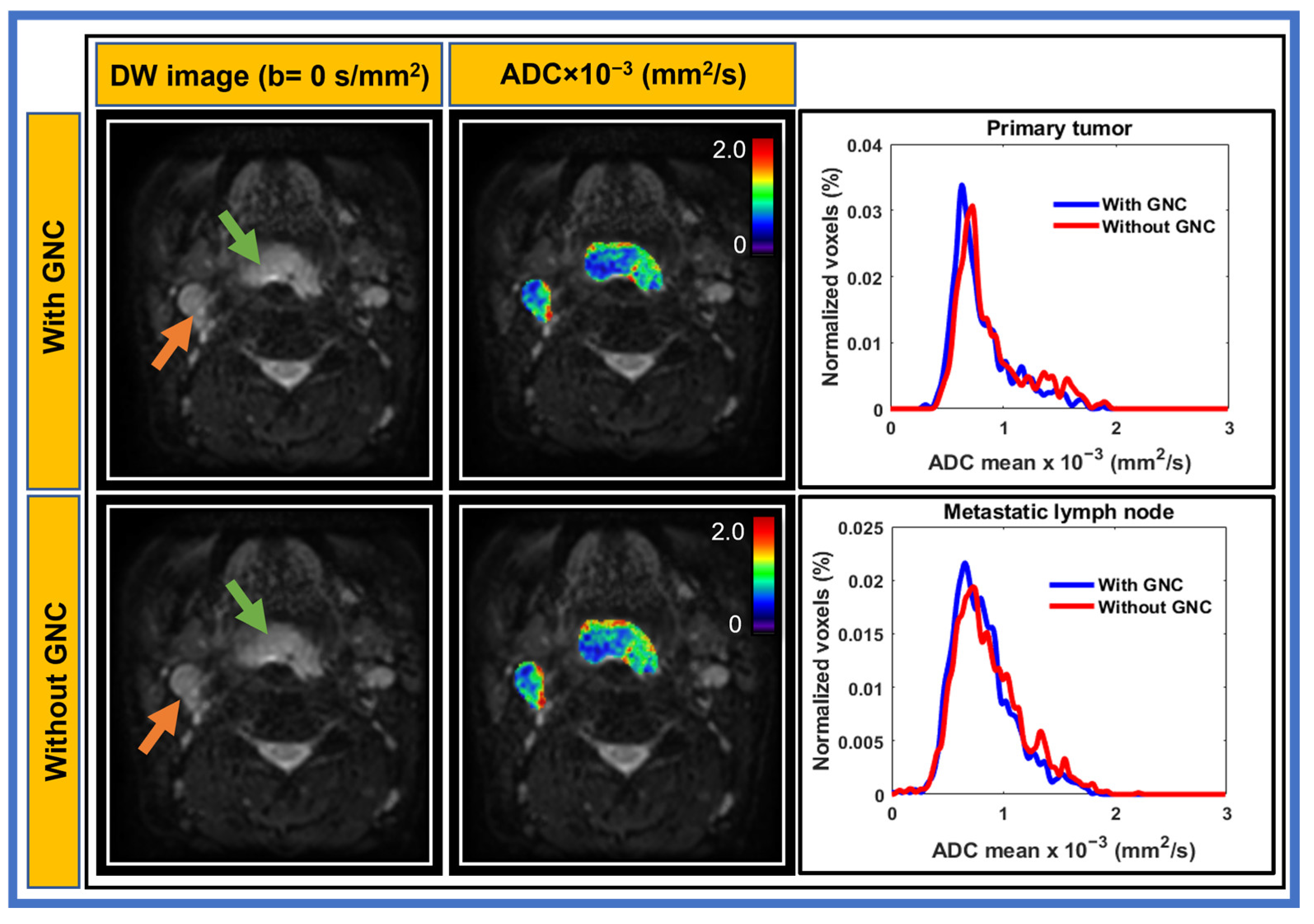 Cancers 17 01796 g002