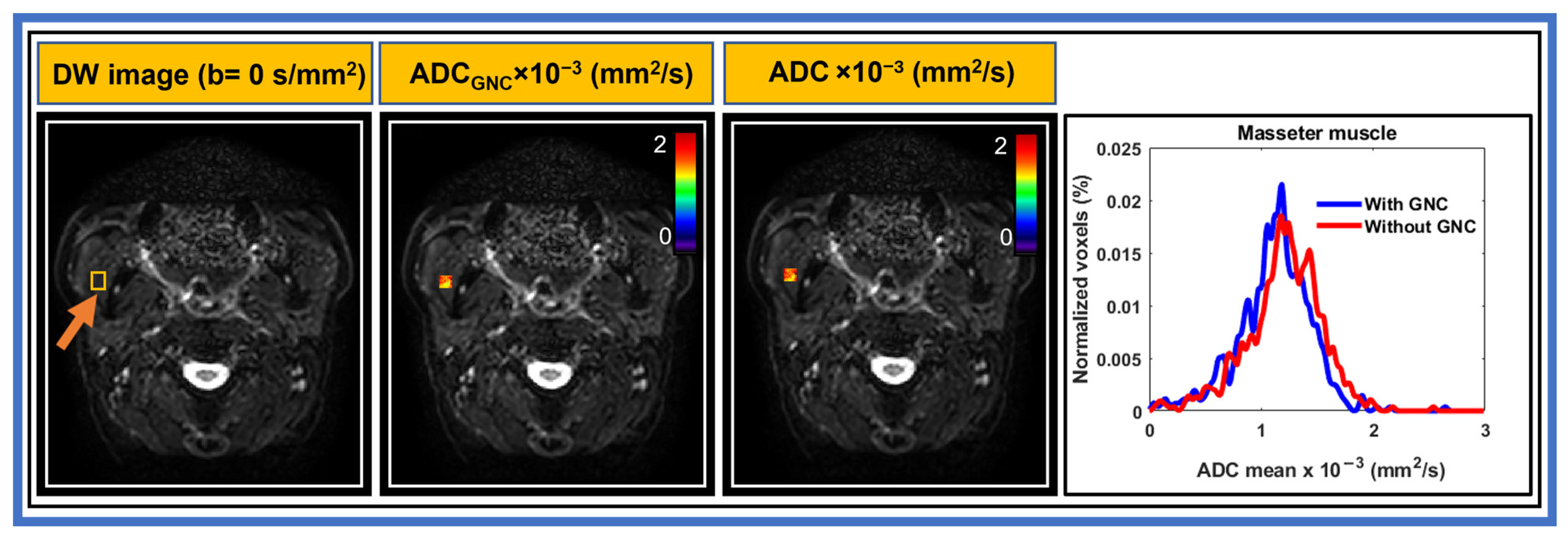 Cancers 17 01796 g003